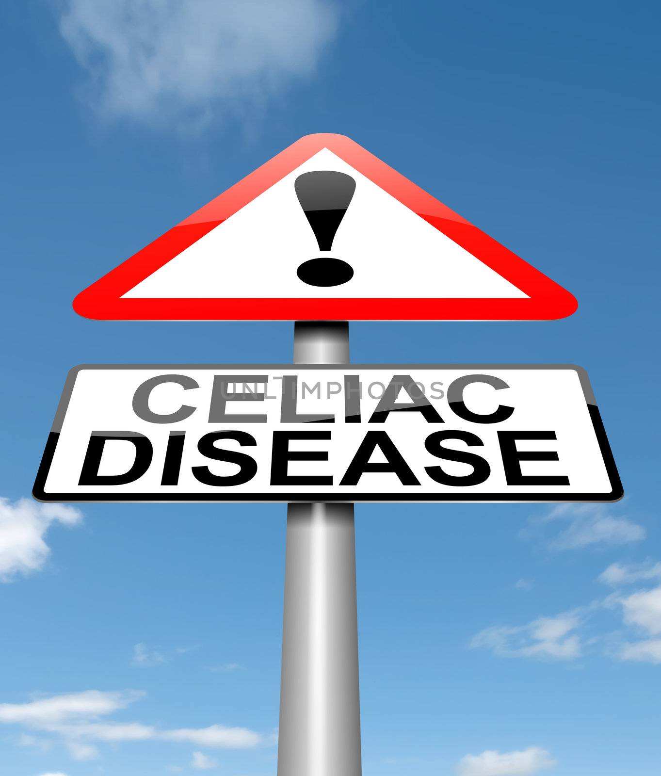 Illustration depicting a sign with a Celiac Disease concept.
