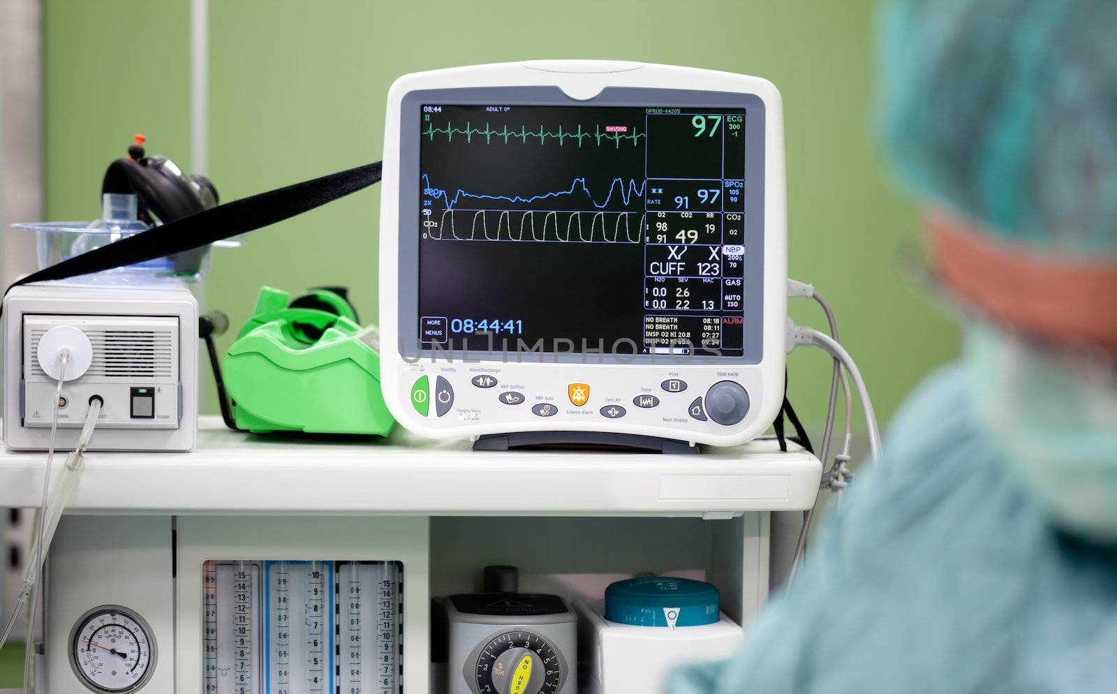 Cardiogram monitor during surgery in operation room