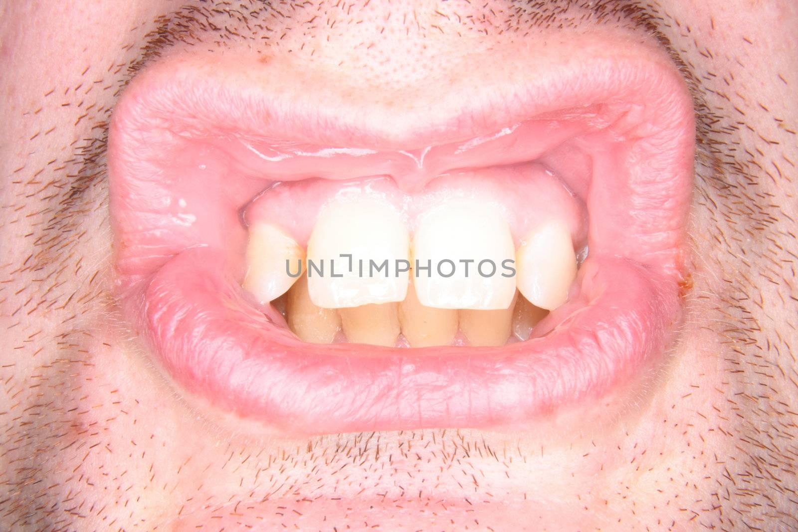 teeth by jonnysek