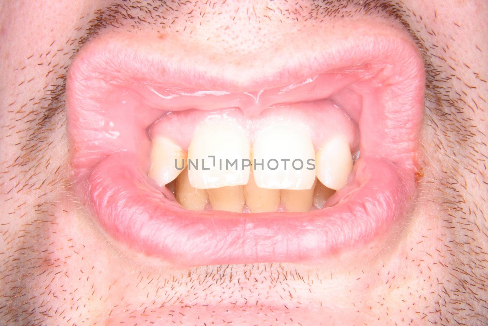 detail of the teeth of young man 