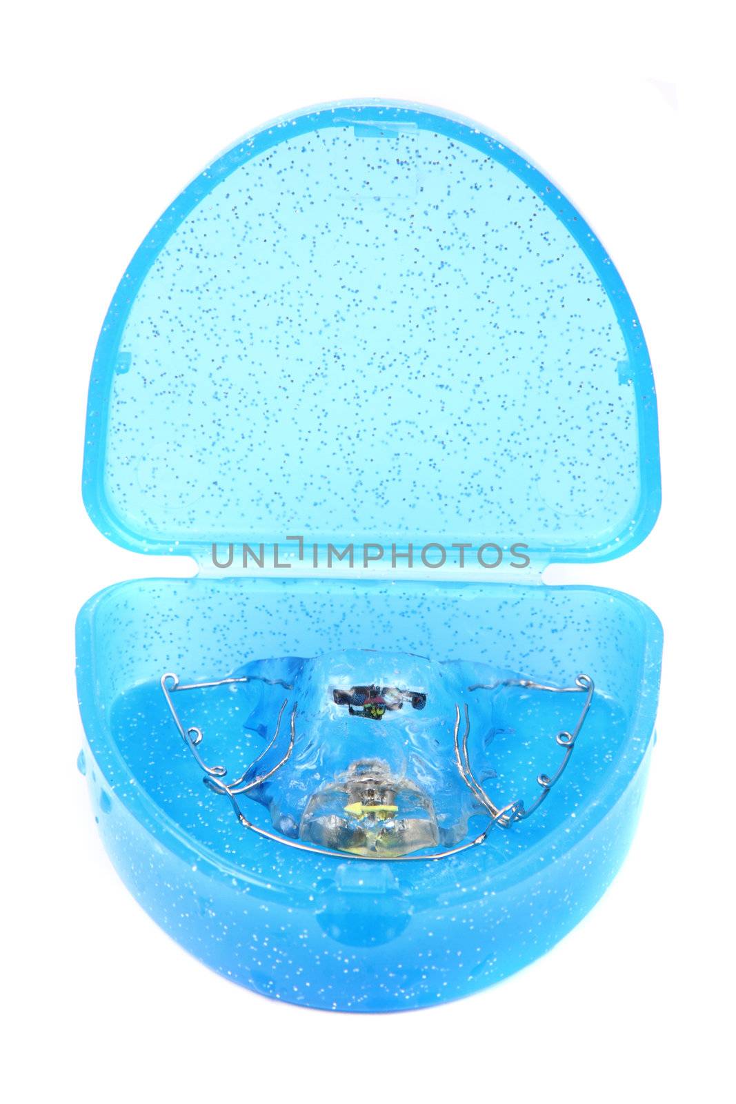 braces (orthodontic tool) isolated on the white background