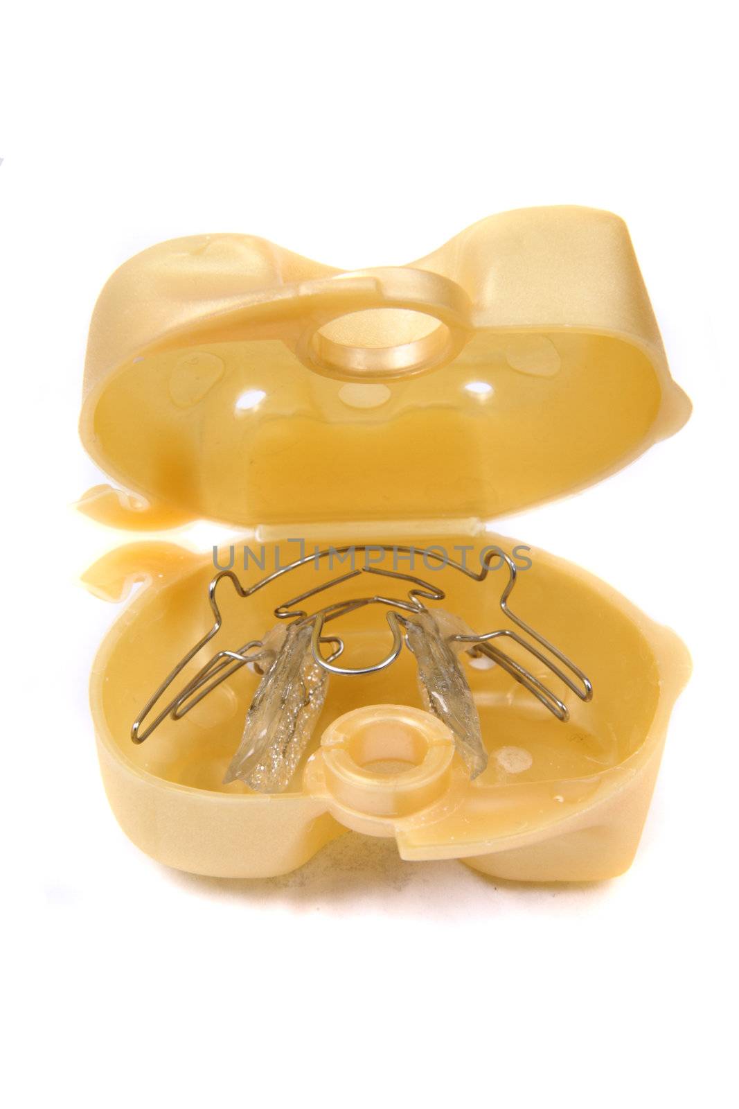 braces (orthodontic tool)  by jonnysek