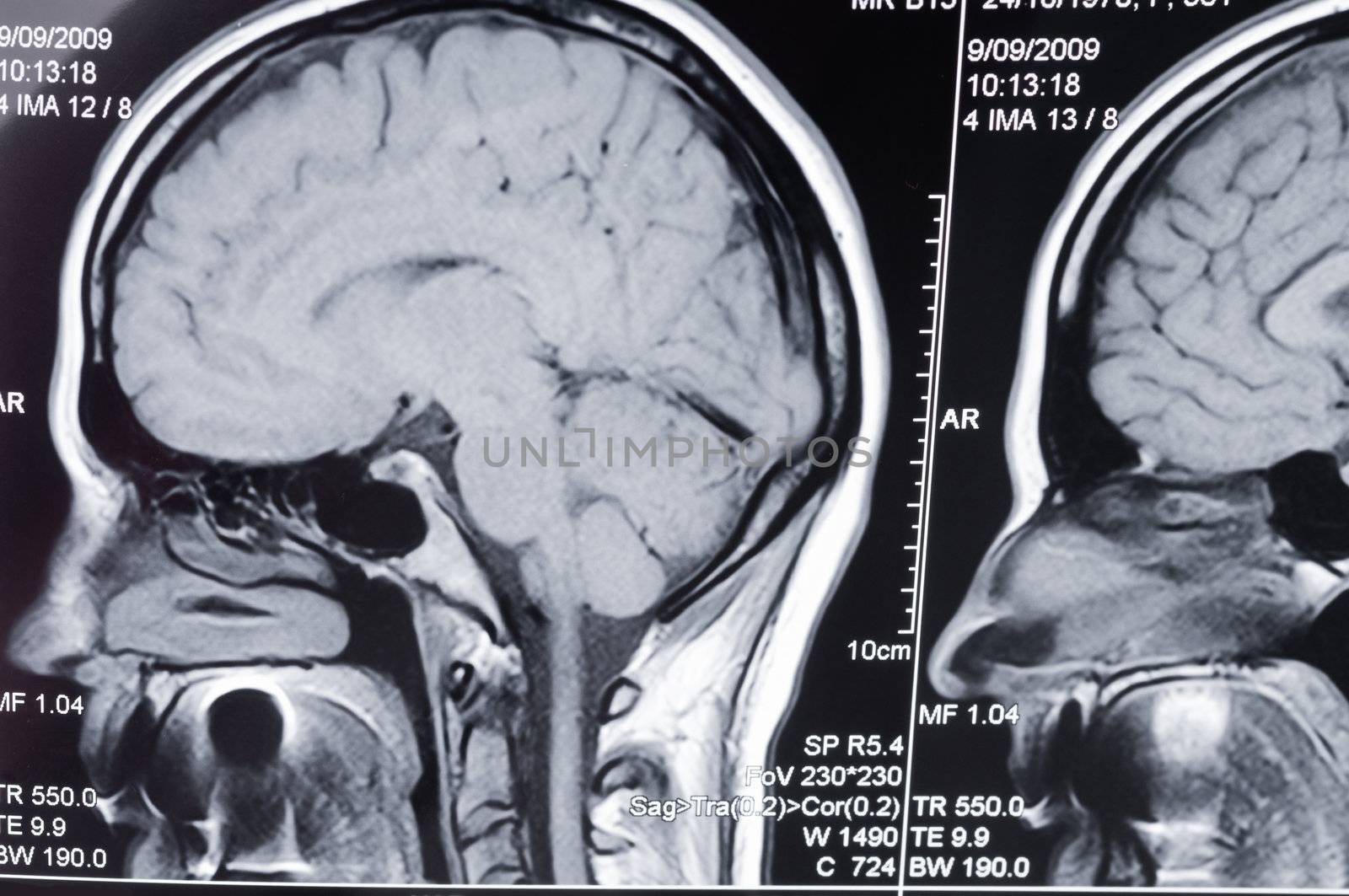 Computer axial tomography scan (CAT) of a head by iryna_rasko