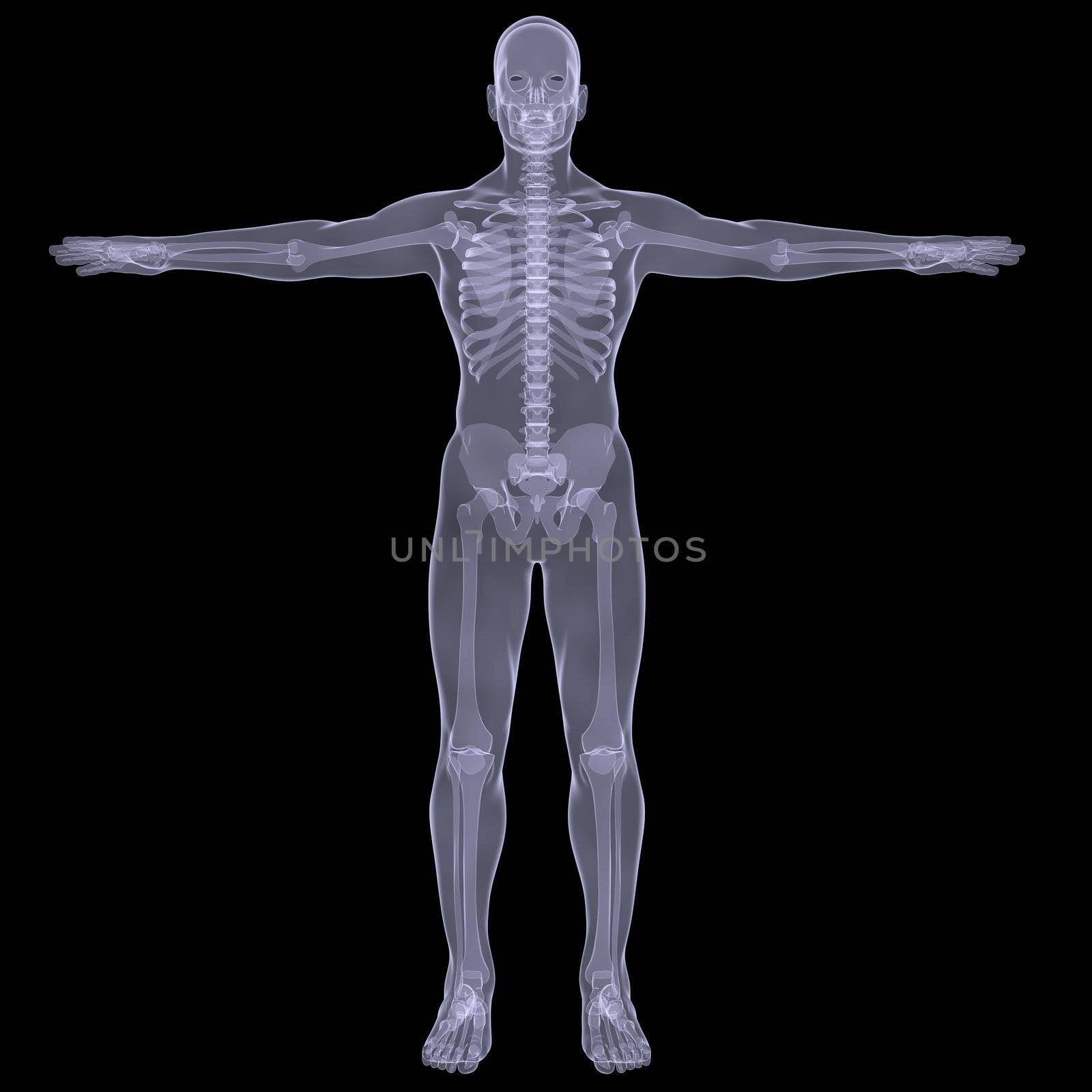 X-ray of man by cherezoff