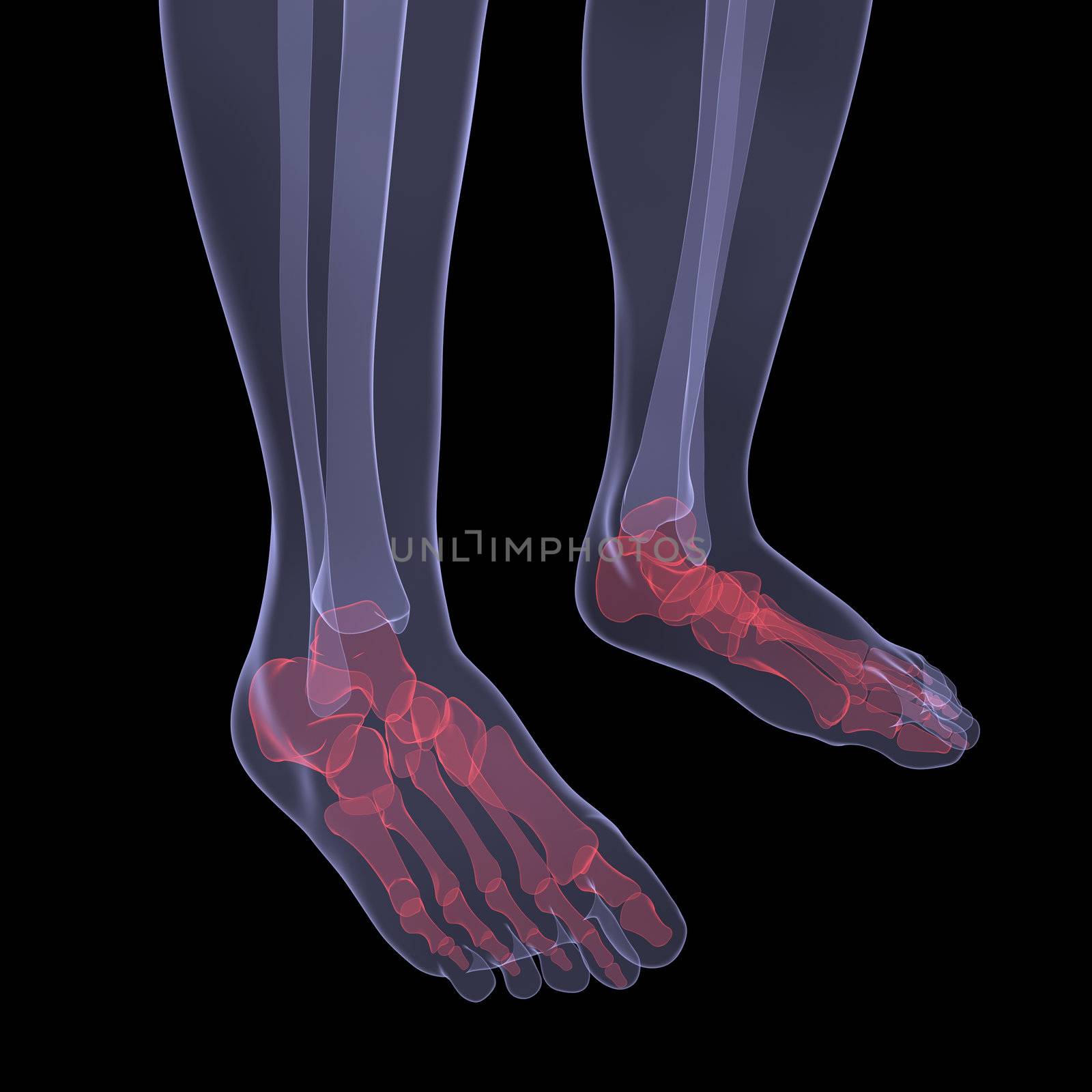X-ray of human legs. Render on a black background