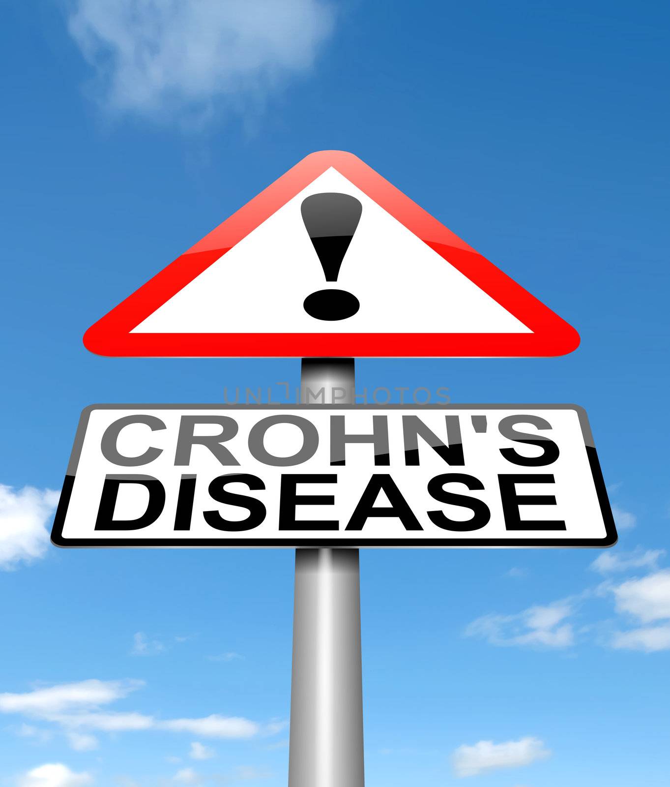 Illustration depicting a sign with a Crohn's Disease concept.