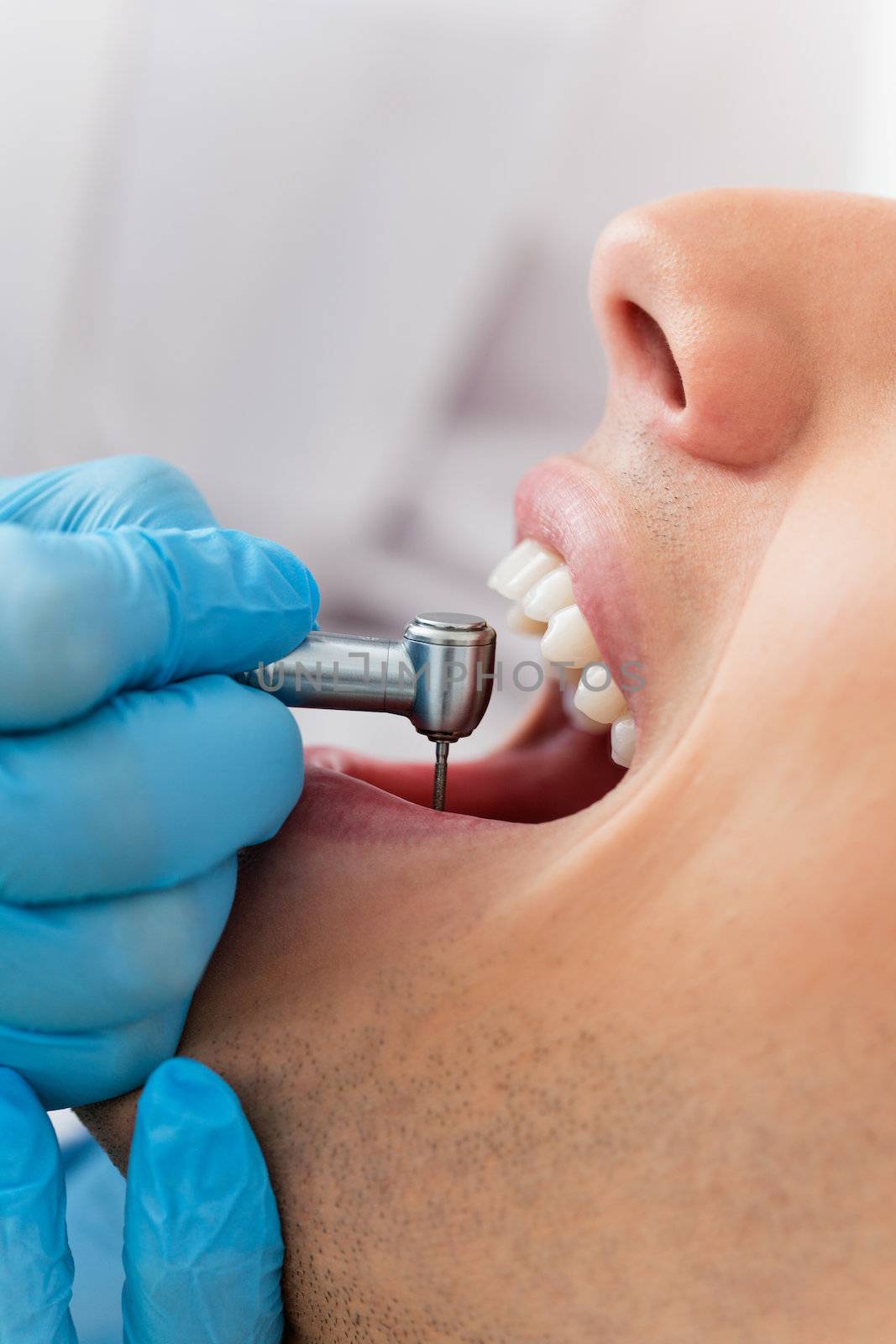 Close-up of dentist using dental drill on patient's teeth