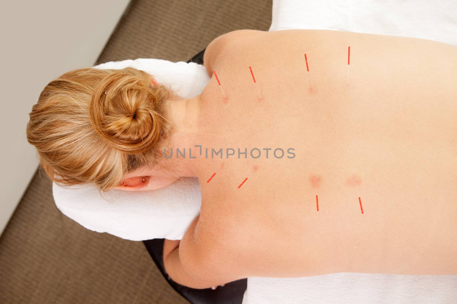 Back Shu Acupuncture Points by leaf