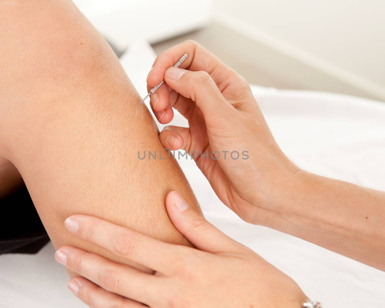 Shonishin pediatric acupuncture on a young boy's leg