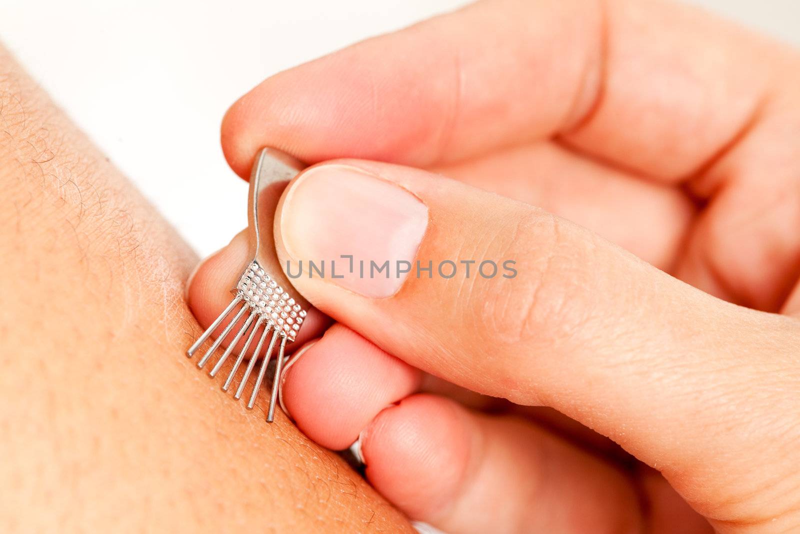 Macro detail of a pine brush Japanese Shonishin acupuncture tool being used on young boy's leg
