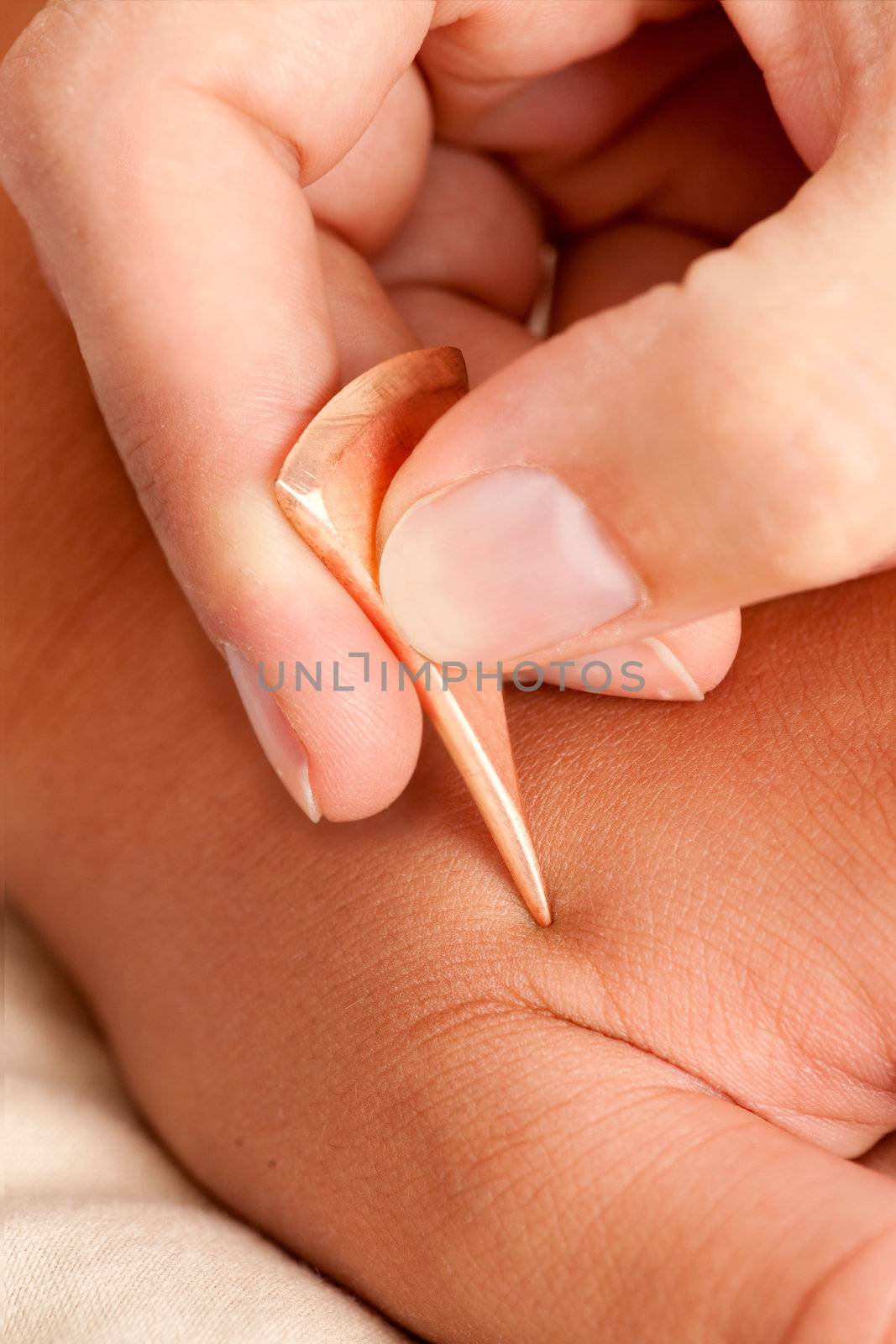 Macro detail of Yoneyama Acupuncture Tool used in Shonishin acupuncture