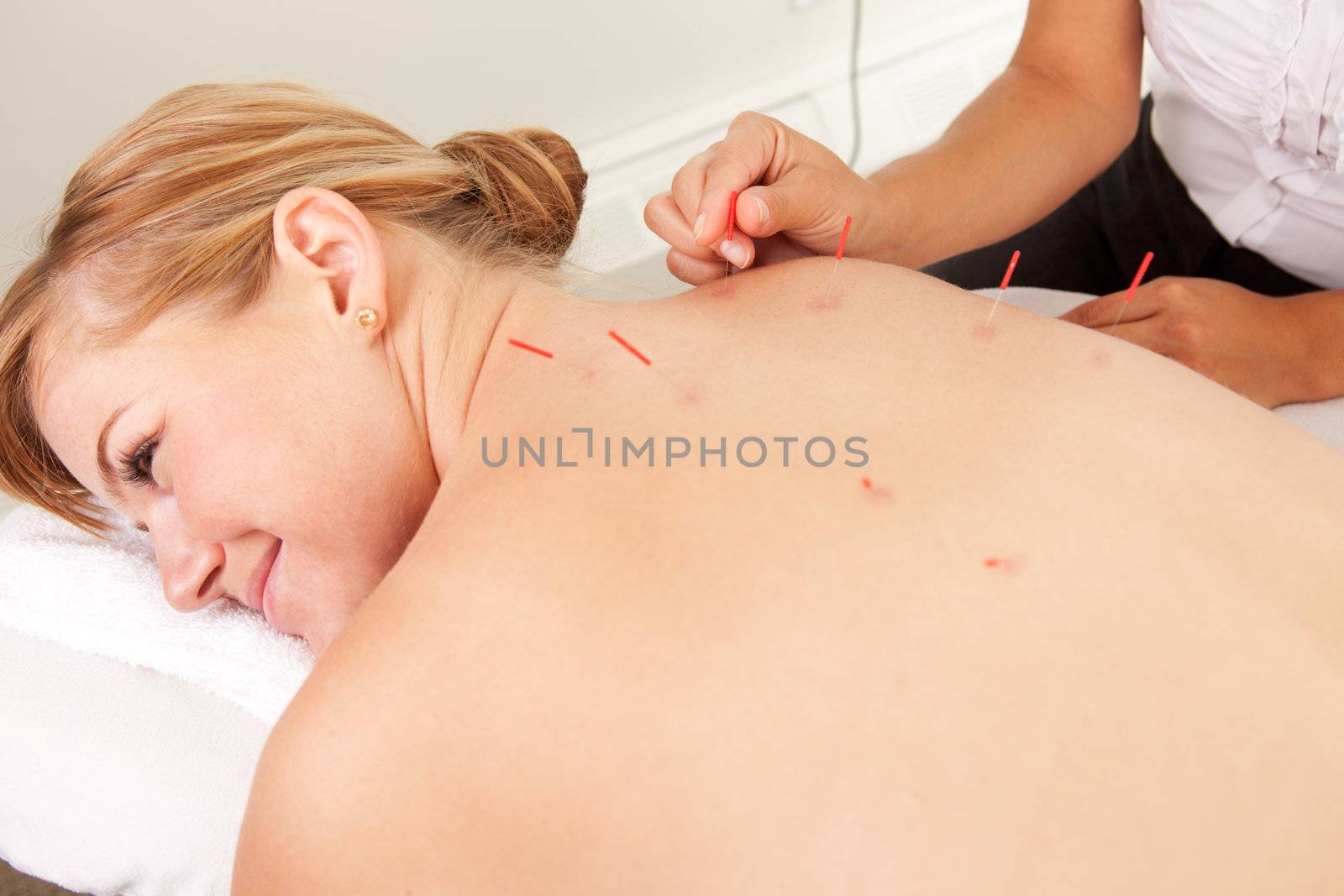 Back Shu Acupuncture by leaf