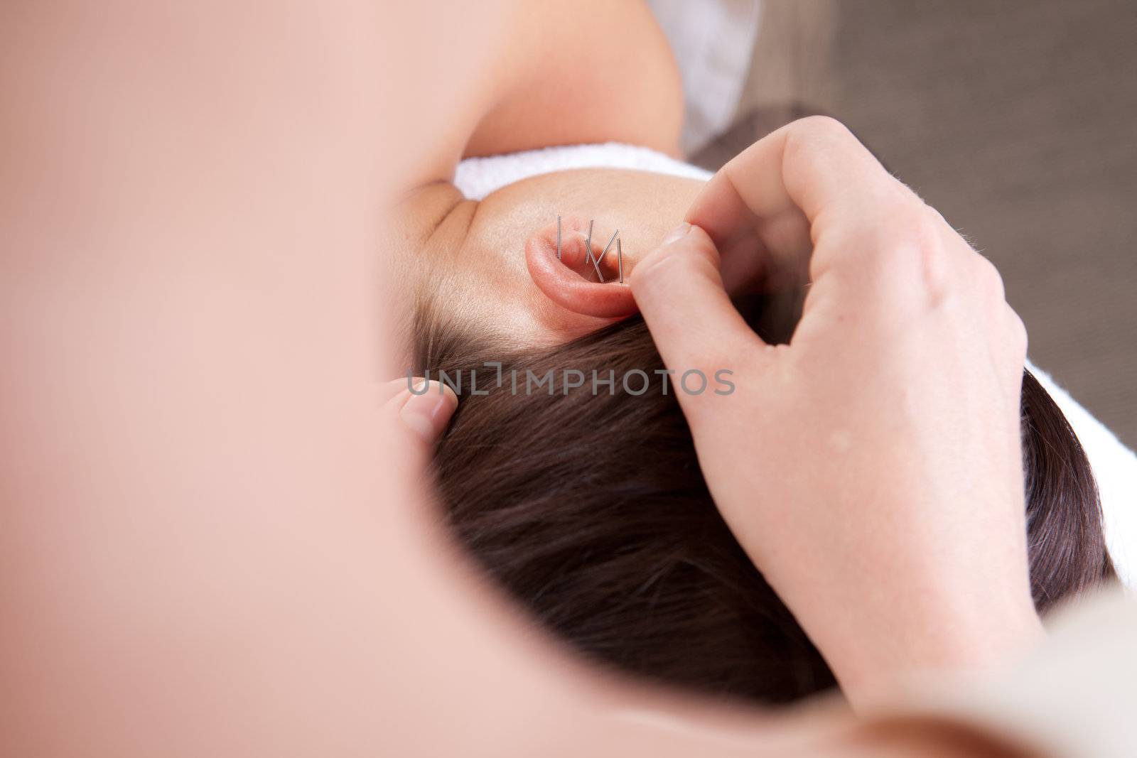 Detail view of professional acupuncturist placing needle in ear of patient
