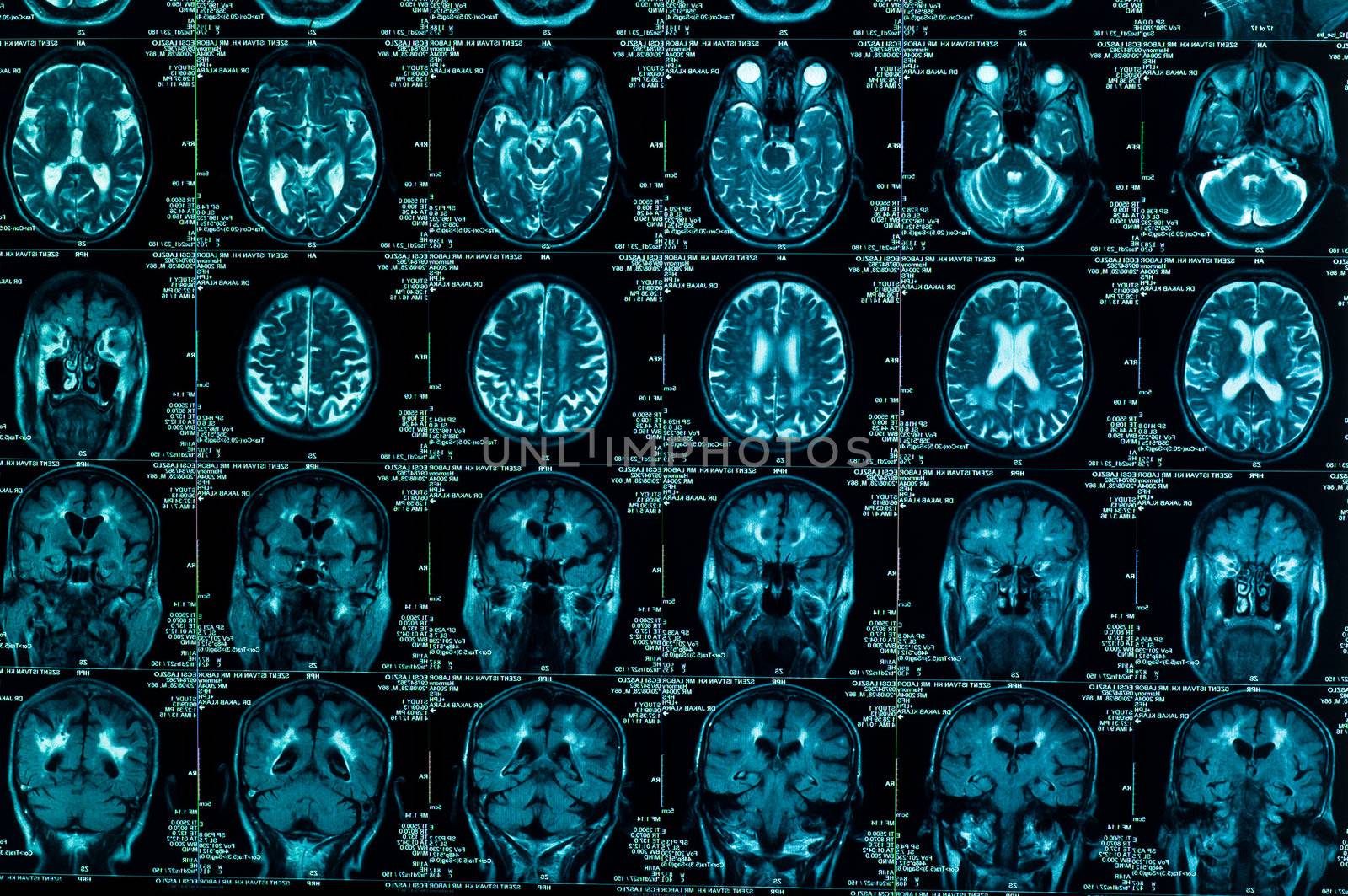 sharp ct scan of the human brain