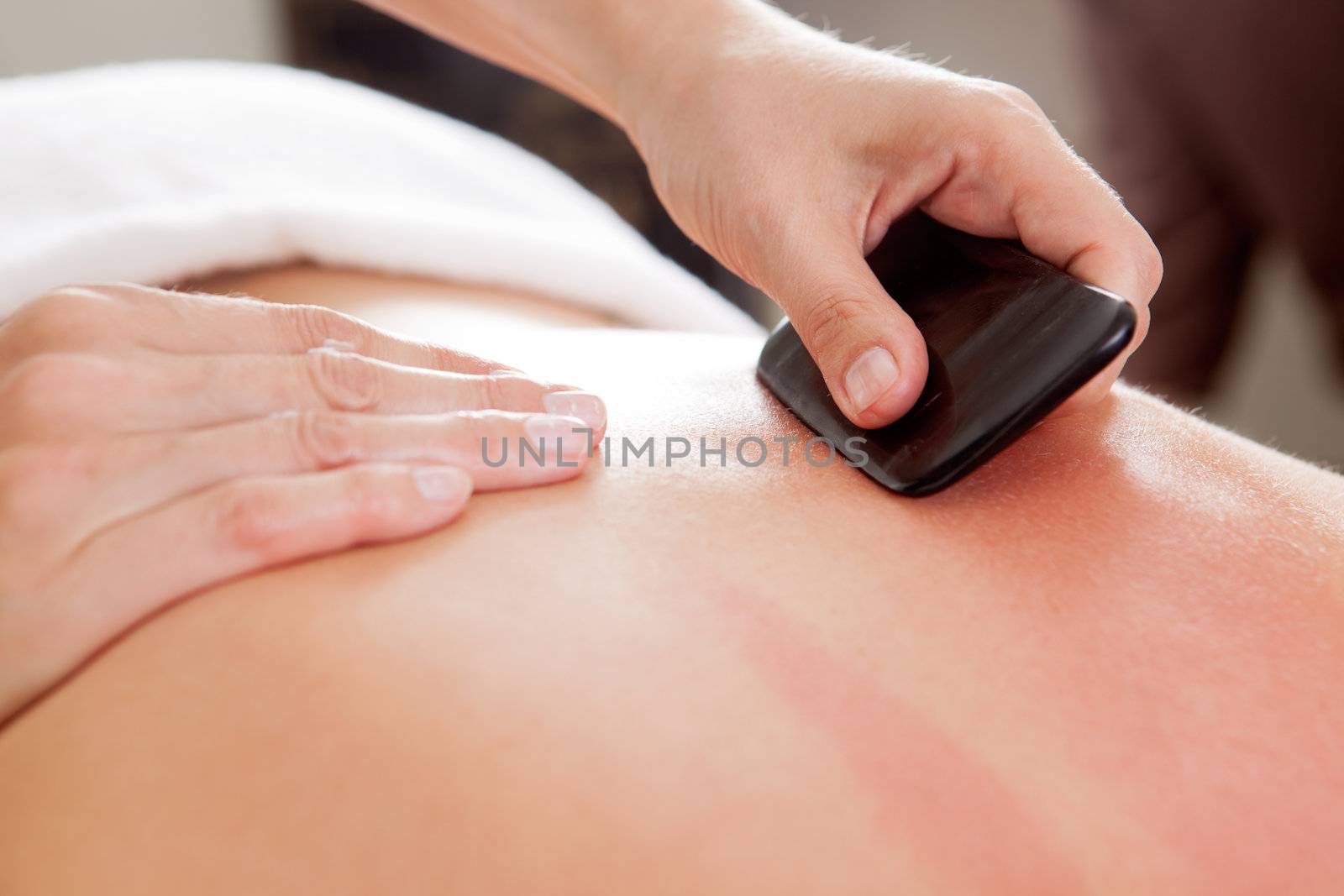 Gua-Sha Acupuncture Treatment on Back by leaf