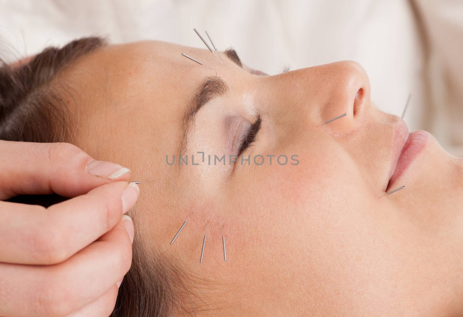 Facial Acupuncture Treatment Detail by leaf