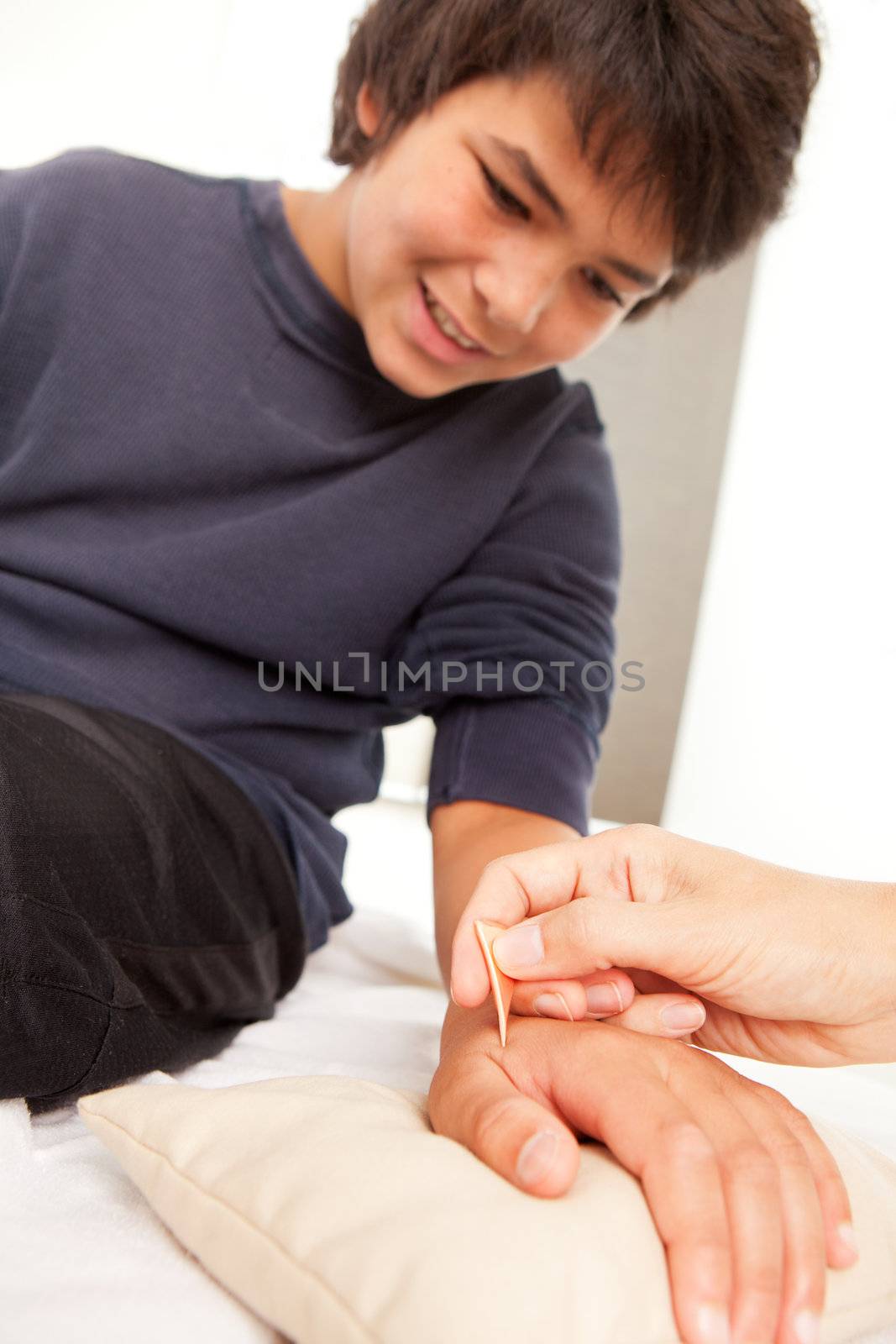 Young male receiving shonishin acupuncture on his hand with a Yoneyama tool.  Shallow depth of field, focus on tool.