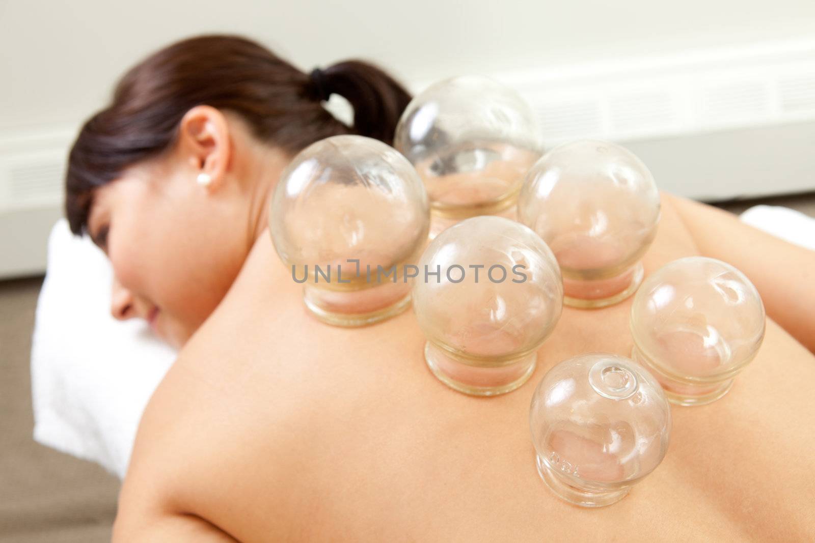 Detail of Woman with Acupuncture Cupping Treatment by leaf