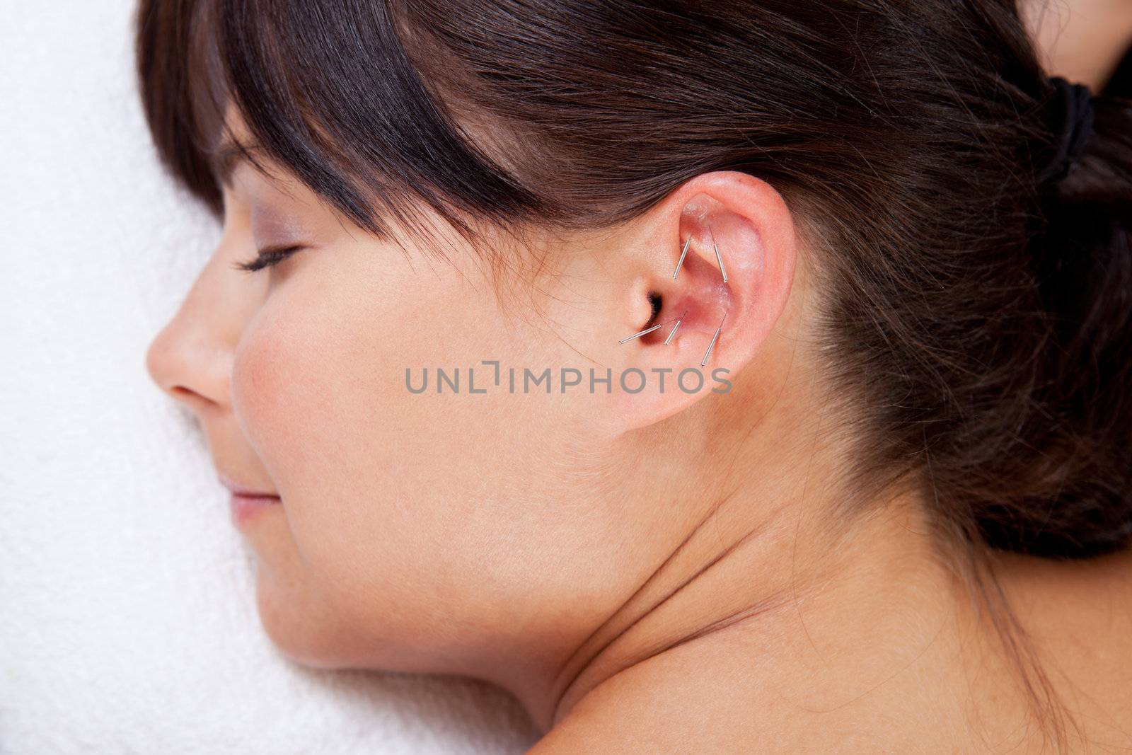 Attractive female relaxing while receiving an acupuncture treatment on the ear