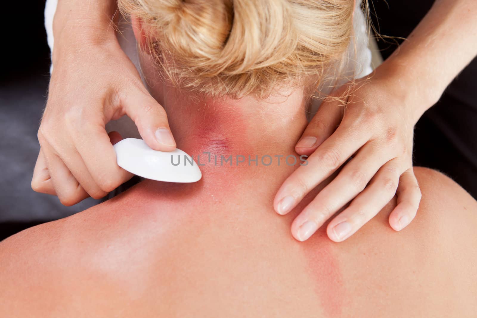 Above view of woman receiving gua-sha treatment on back and neck