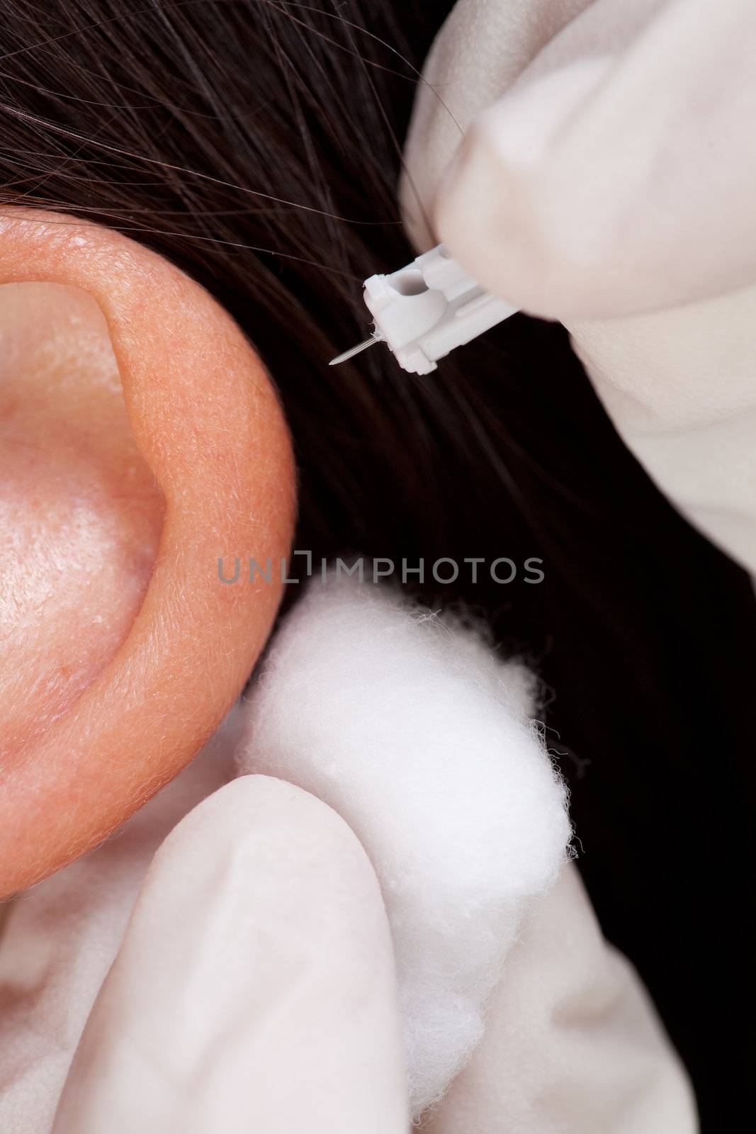 Macro detail of a acupuncture therapist about to lance the apex of an ear