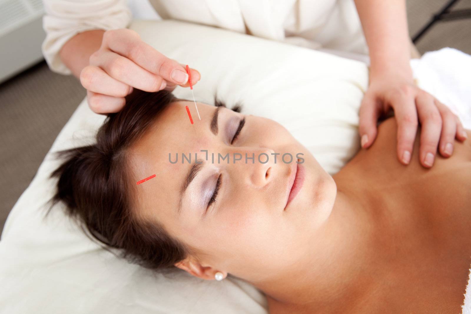 Facial Acupuncture Treatment Needle Stimulation by leaf