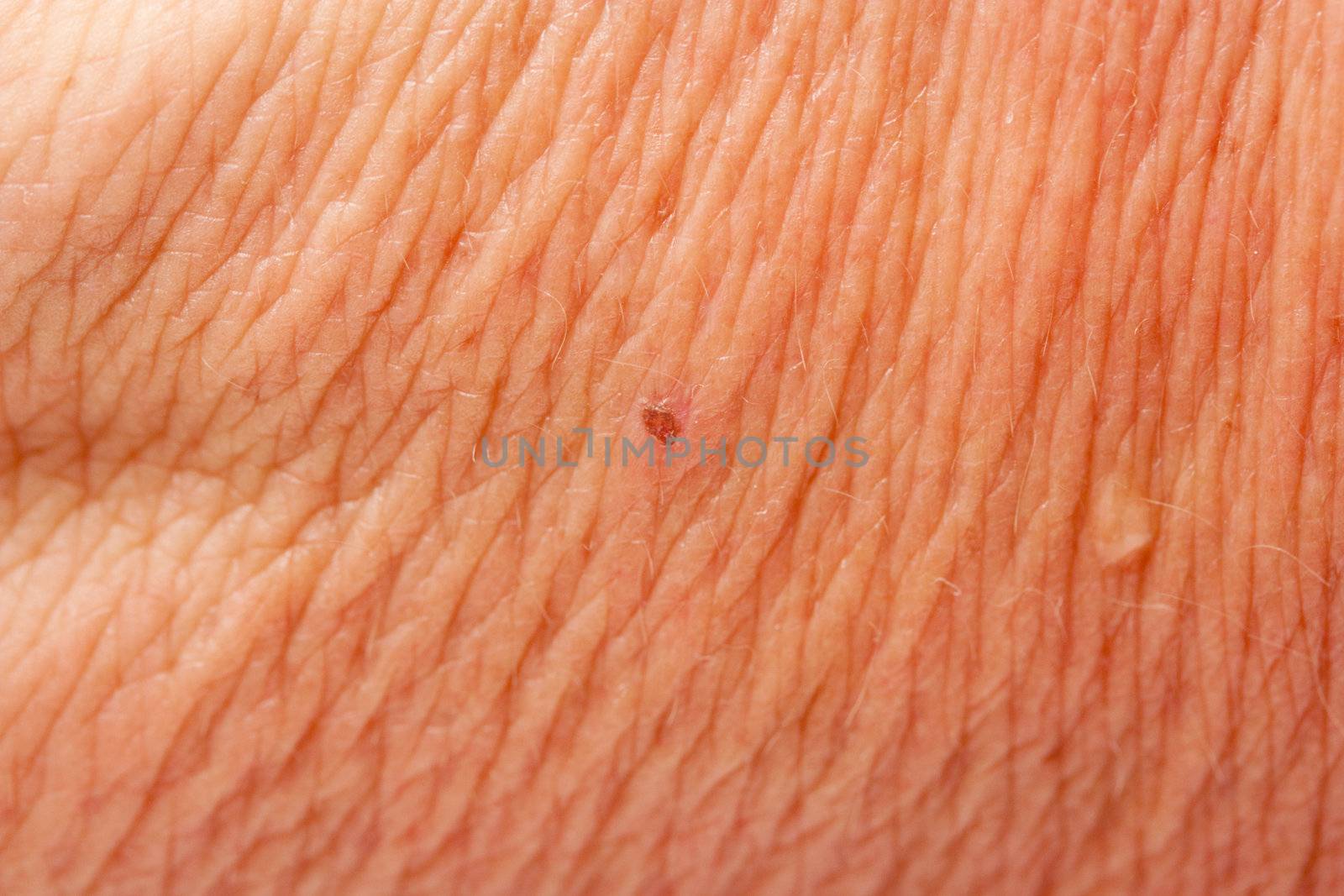 human skin as a background