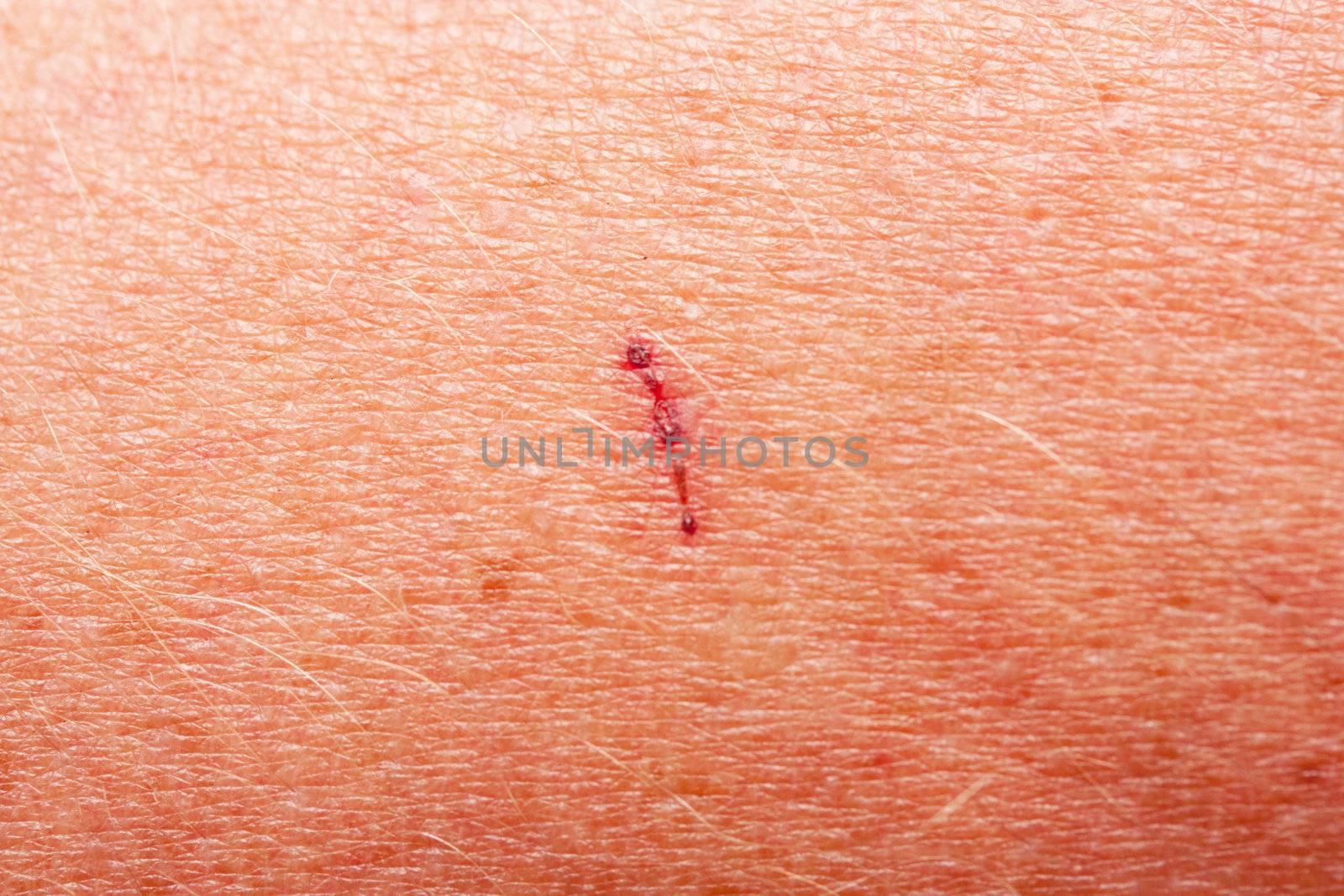 human skin as a background