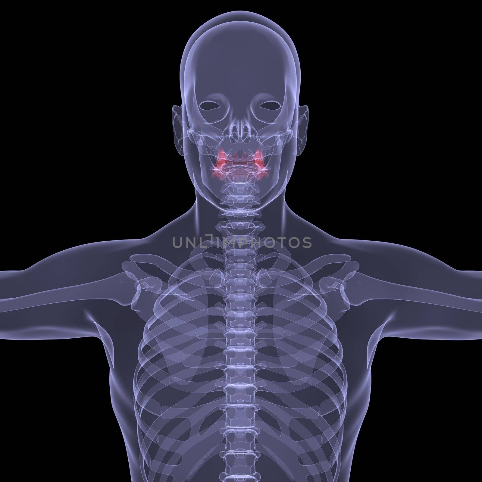 X-Ray picture of a person. Sore digestion by cherezoff