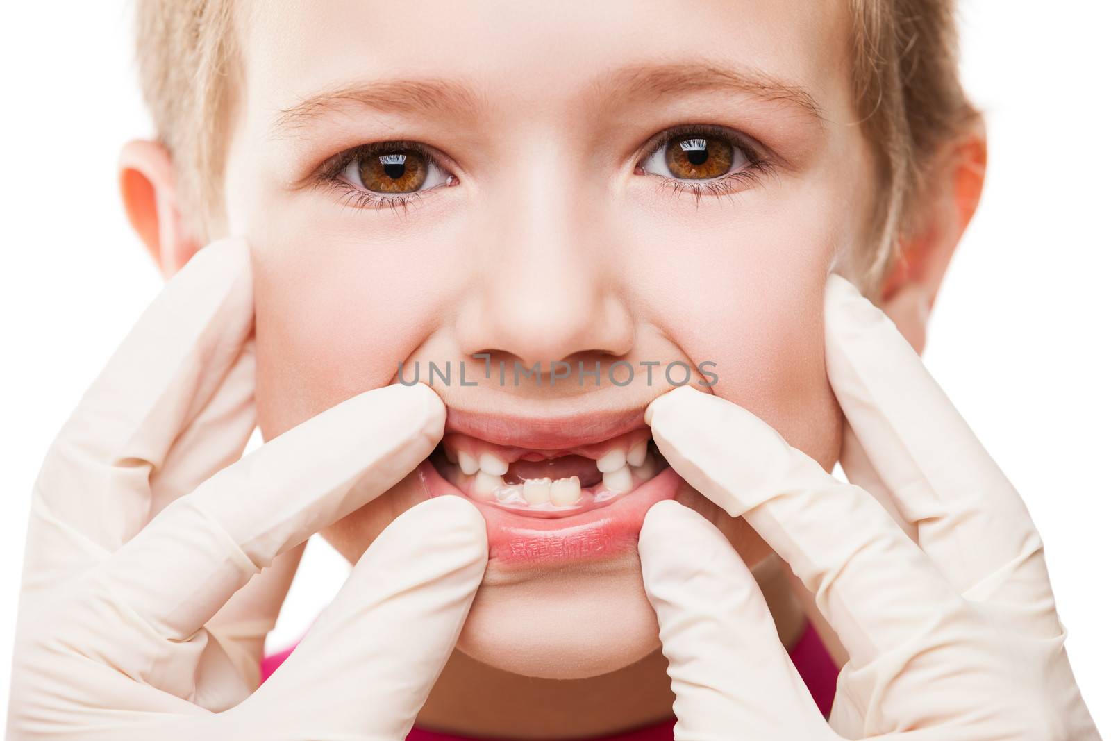 Dental medicine and healthcare - child patient open mouth showing first baby milk or temporary teeth fall out