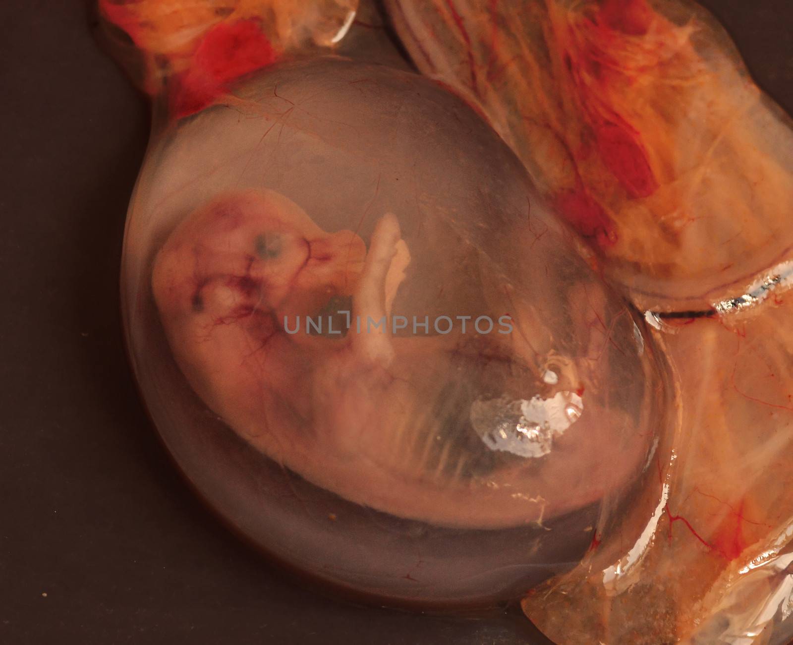 aborted embryo
