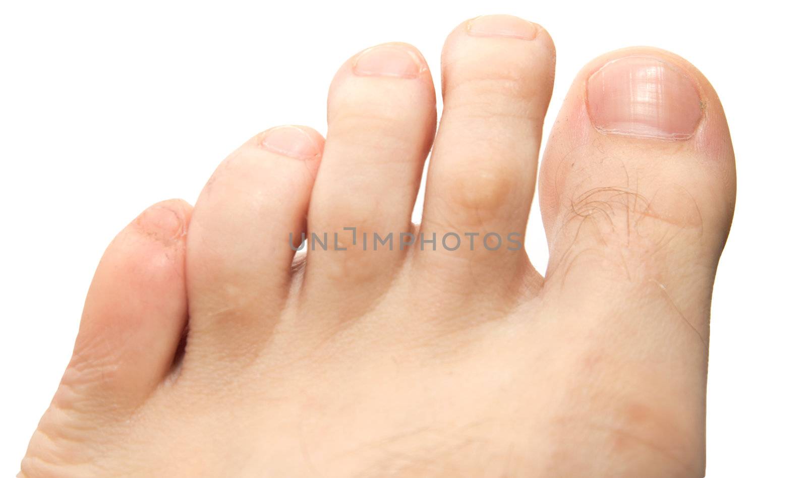 men's toes on a white background