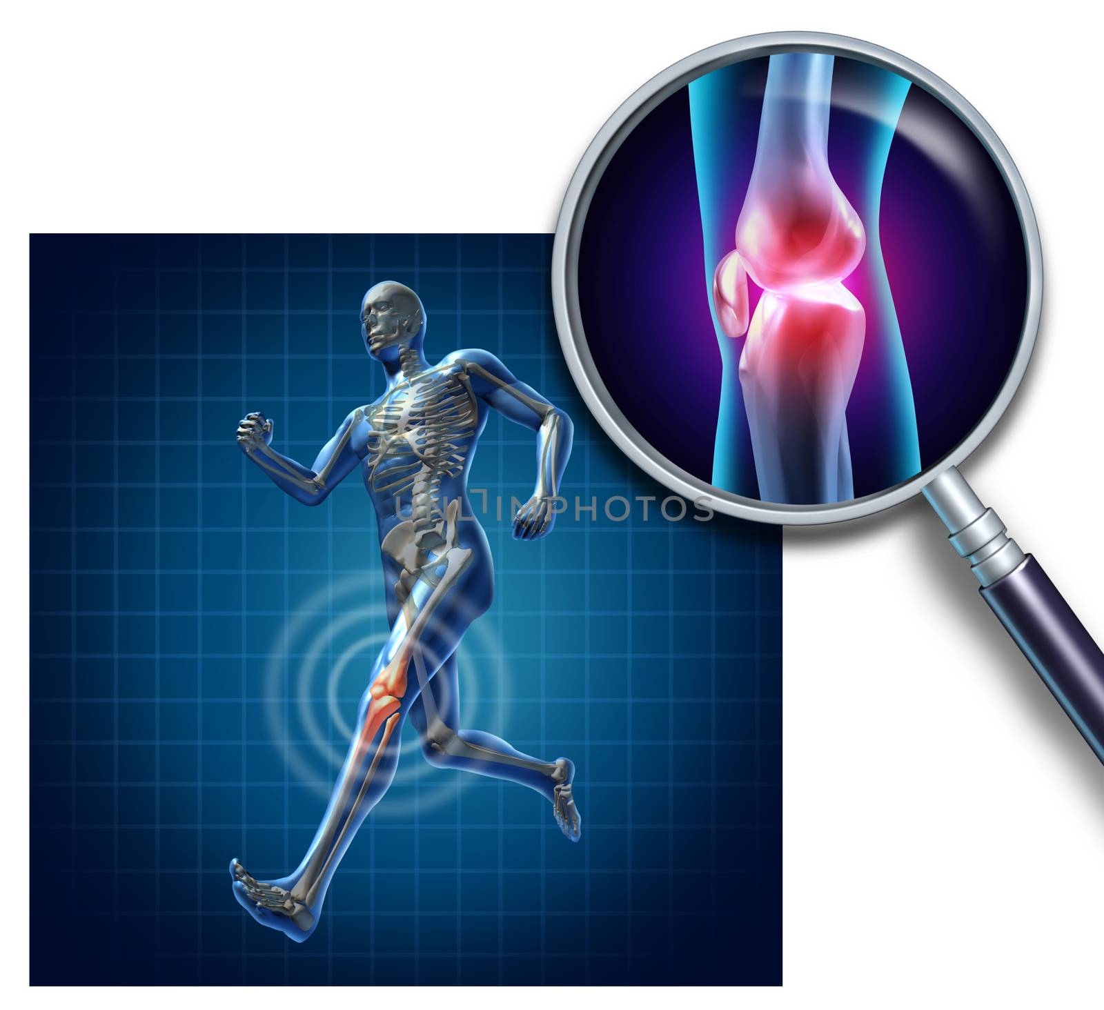 Sports knee injury with a running athlete showing the anatomical skeleton with a red highlight on the knee magnified with a magnifying glass as a symbol of body joint pain.