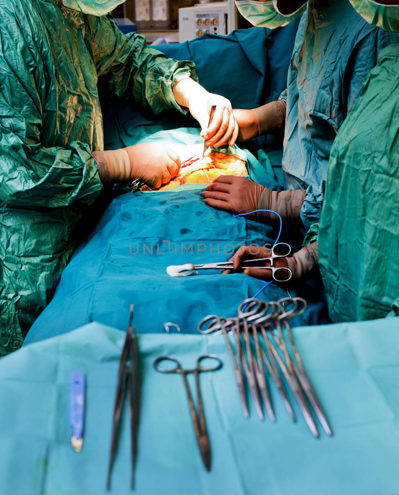 Doctors with medical uniforms performing cardiac surgery