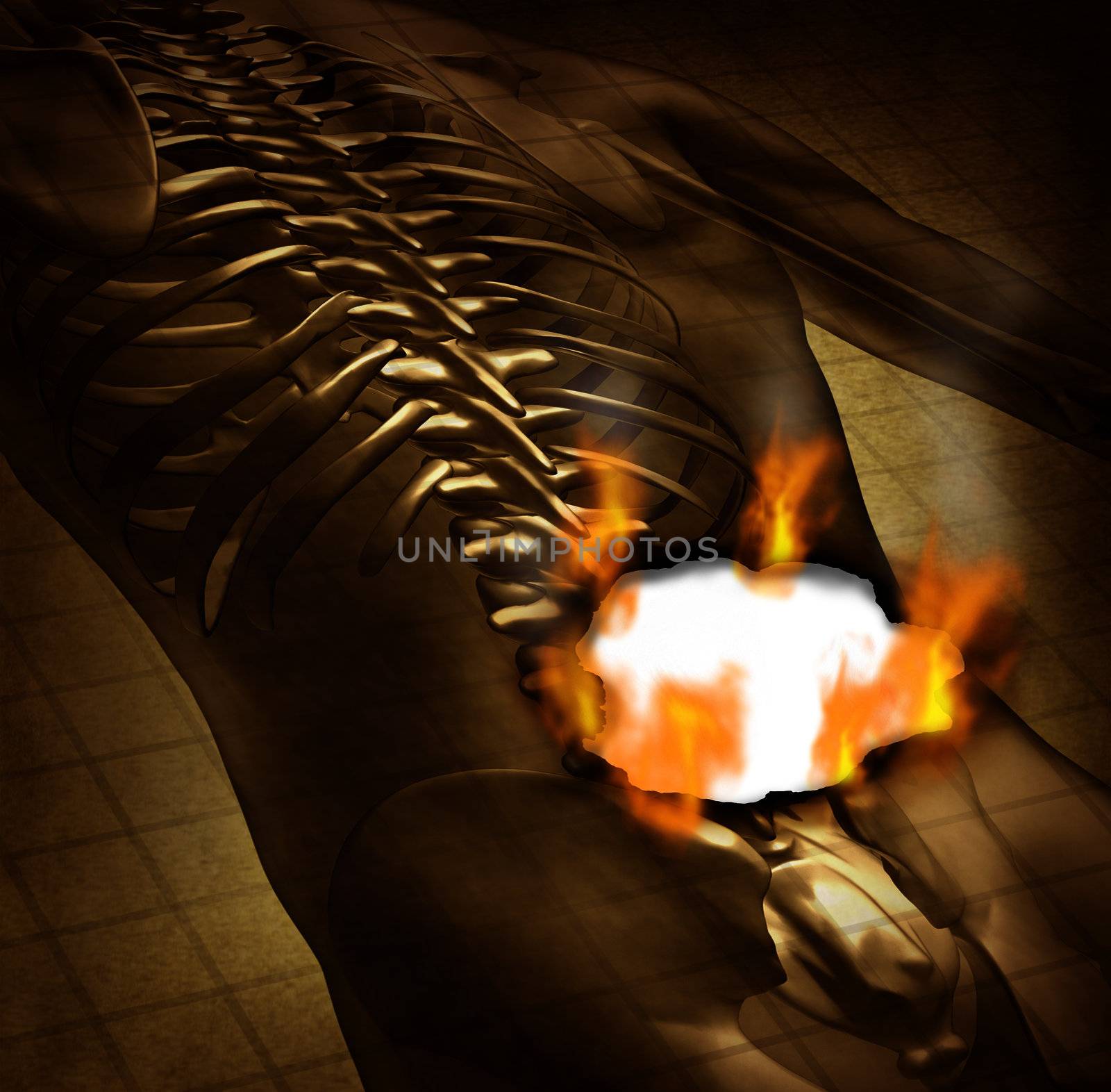 Human burning back pain and backache medical concept with a grunge old document of an upper torso body skeleton with the spine and vertebral column being burnt with fire flames and smoke as a health care symbol for spinal problems.