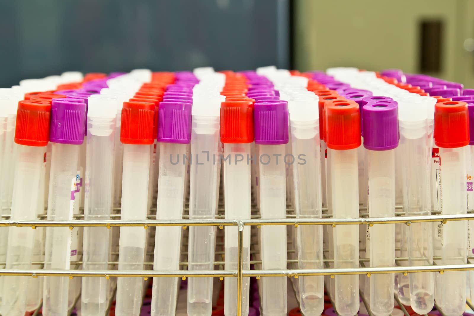 Medical test-tube with blood samples