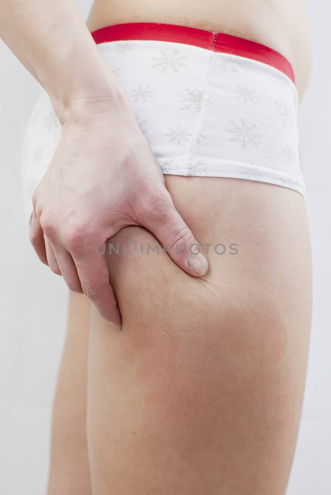 young woman holding her skin for cellulite check