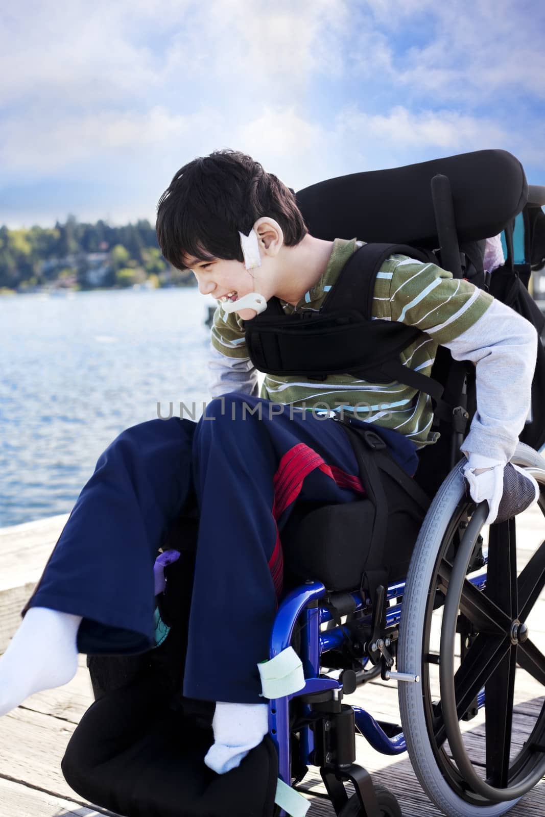 Disabled little boy in wheelchair out on pier by lake by jarenwicklund