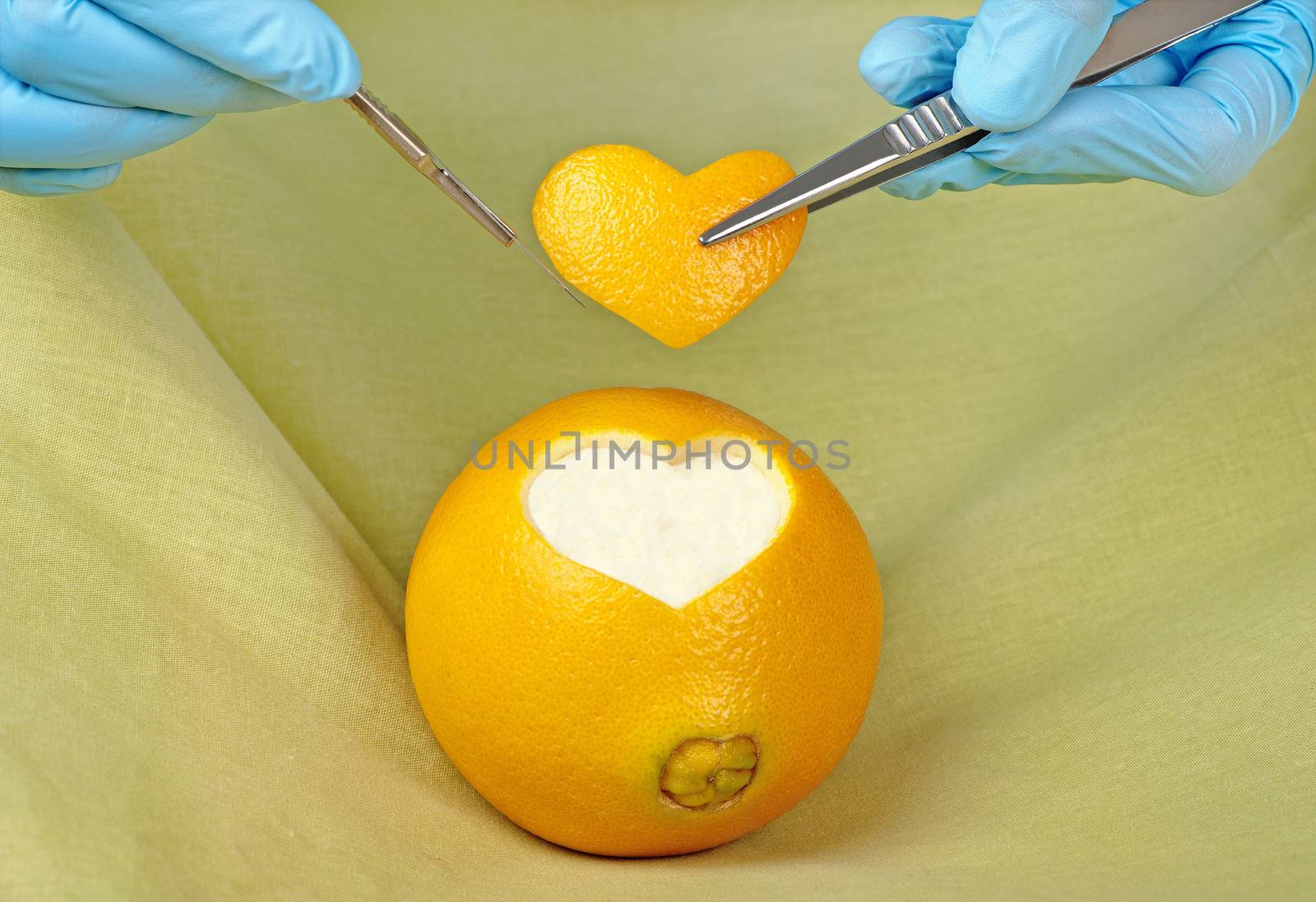 A surgeon excises  a piece in the shape of a heart from an orange.