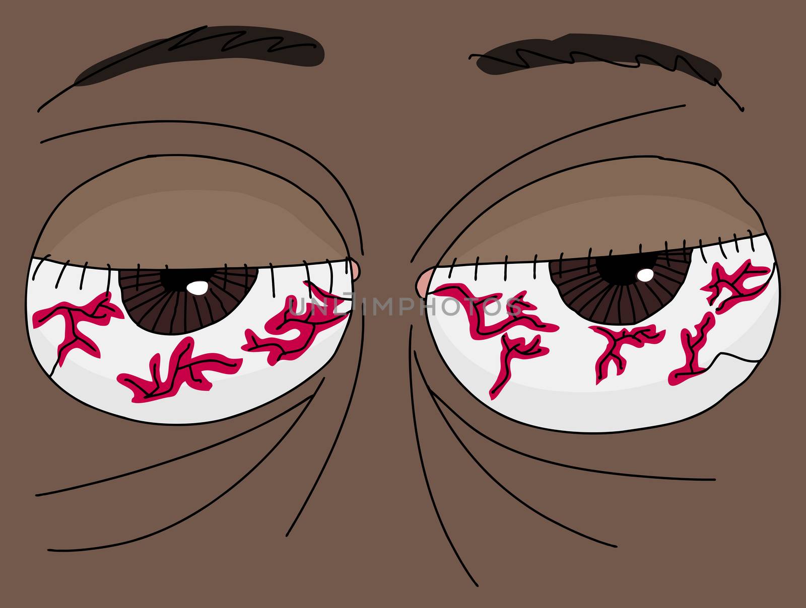 Bloodshot Eyes by TheBlackRhino