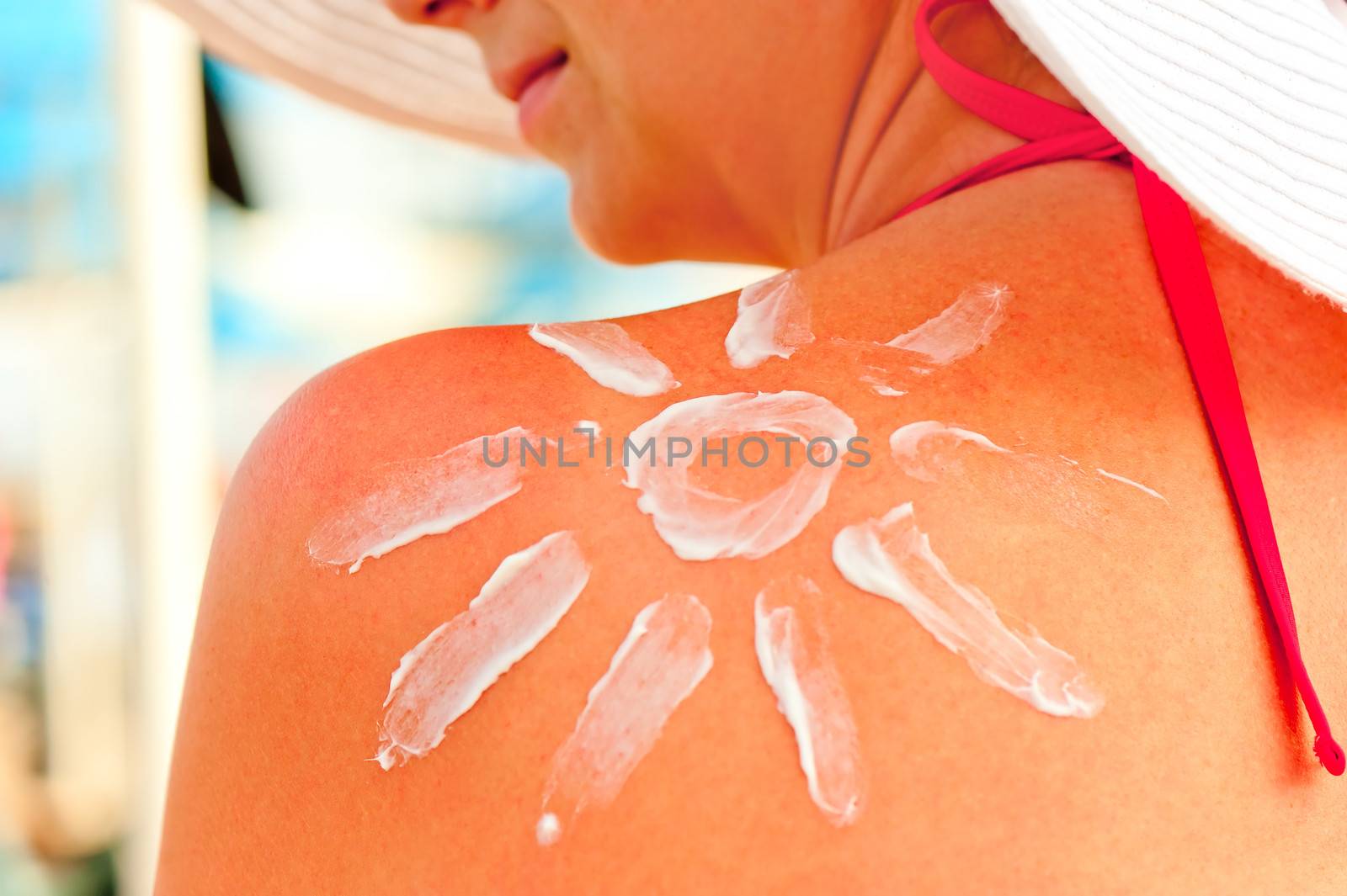 protective sun cream on a woman's shoulder