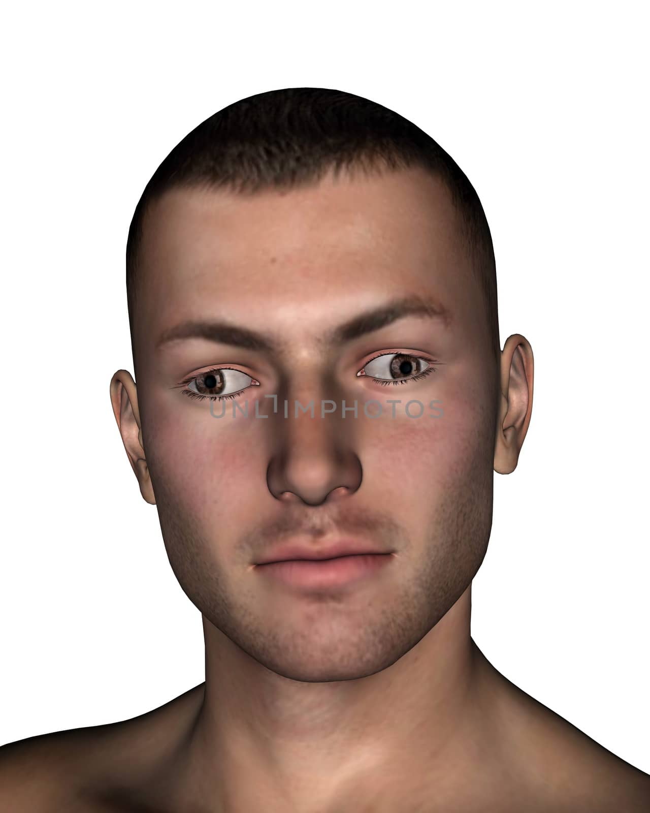 Young man presenting exotropia, eyes turns inward, in white background