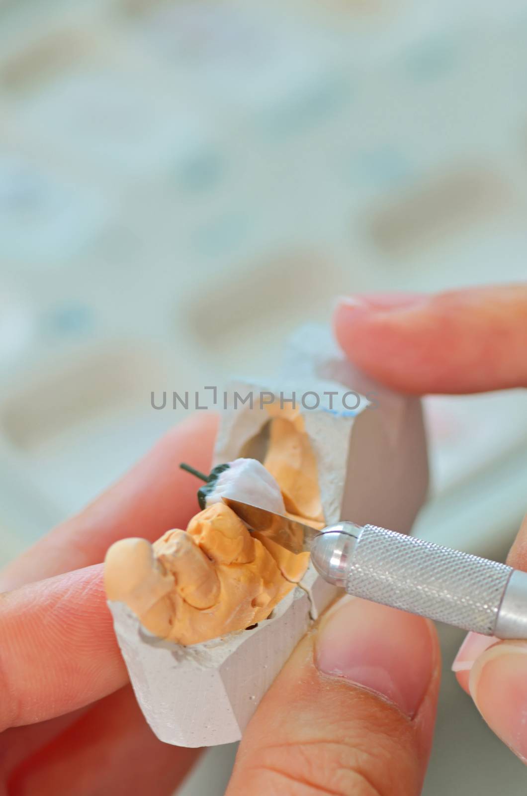 hand of dental technician working on ceramic inlays in a lab