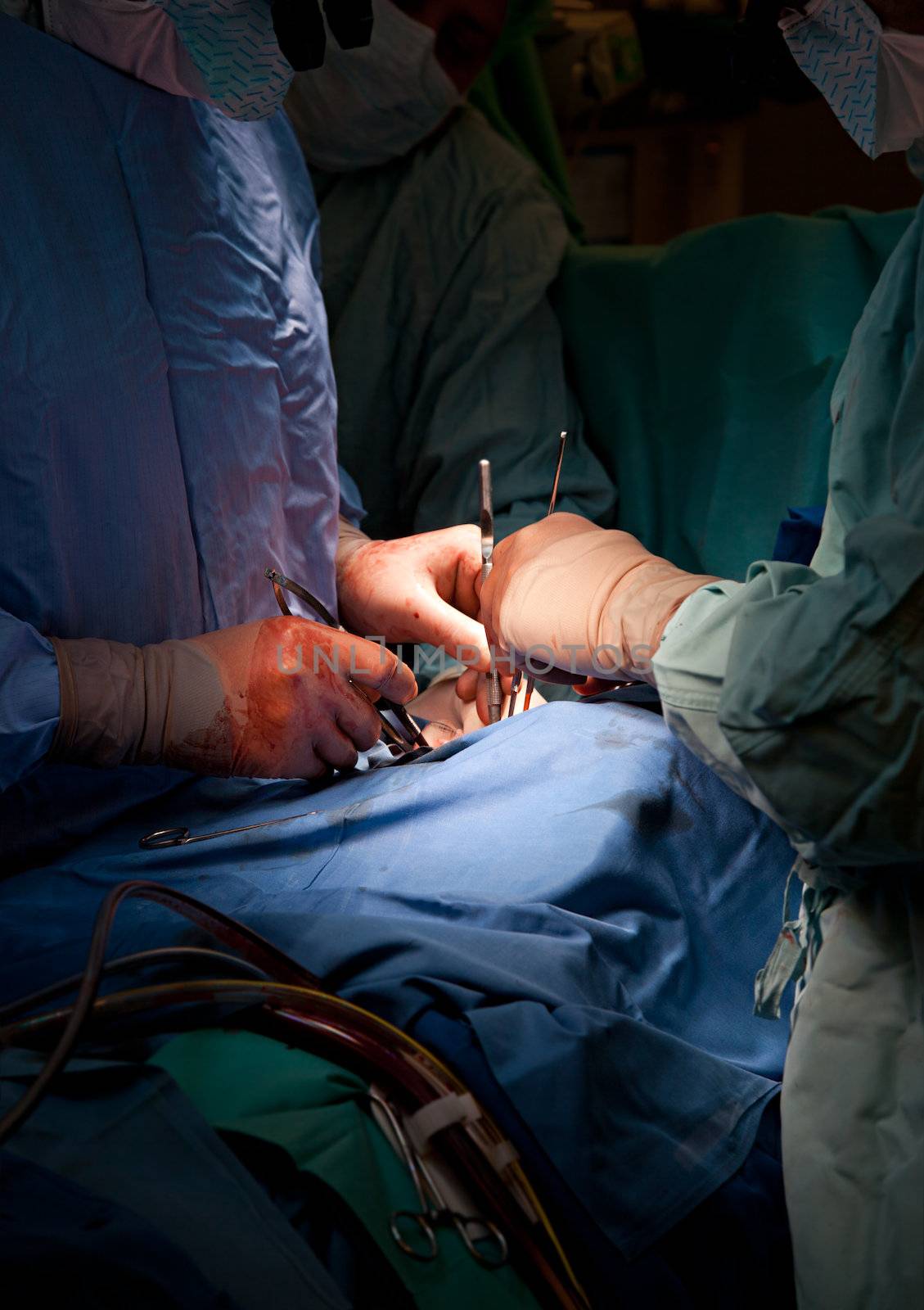 operation of a patient in sterile surgery