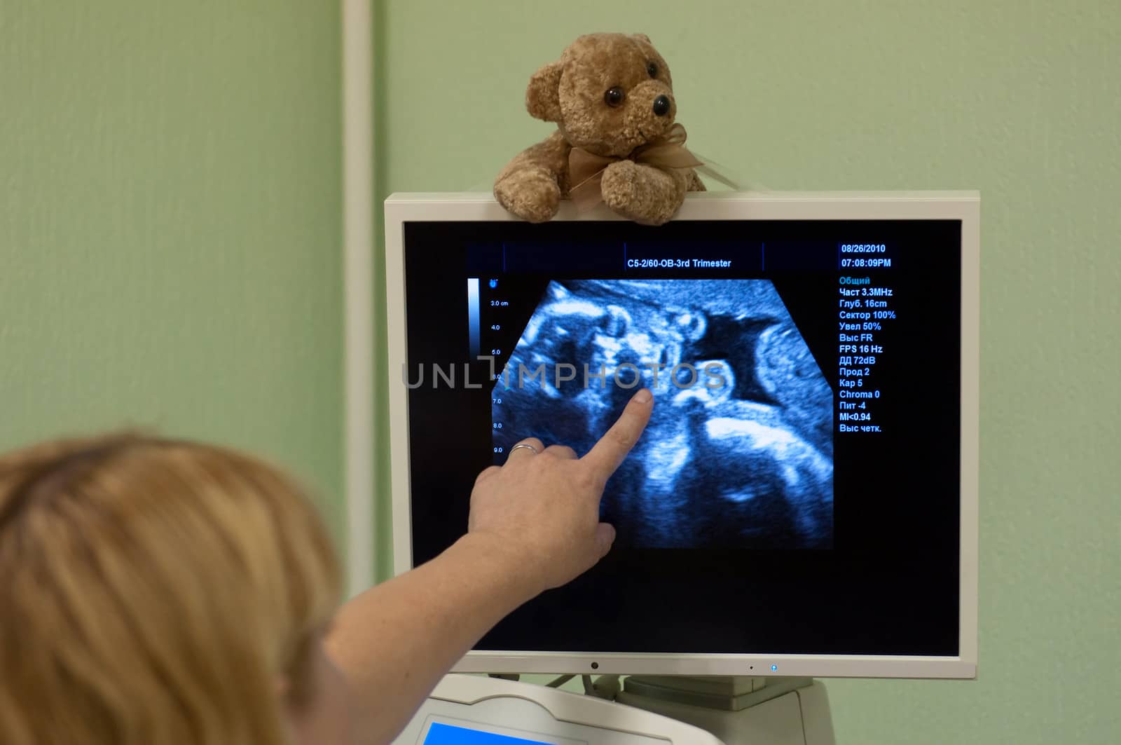 Obstetrician examining pregnant belly by ultrasonic scan. by lexan