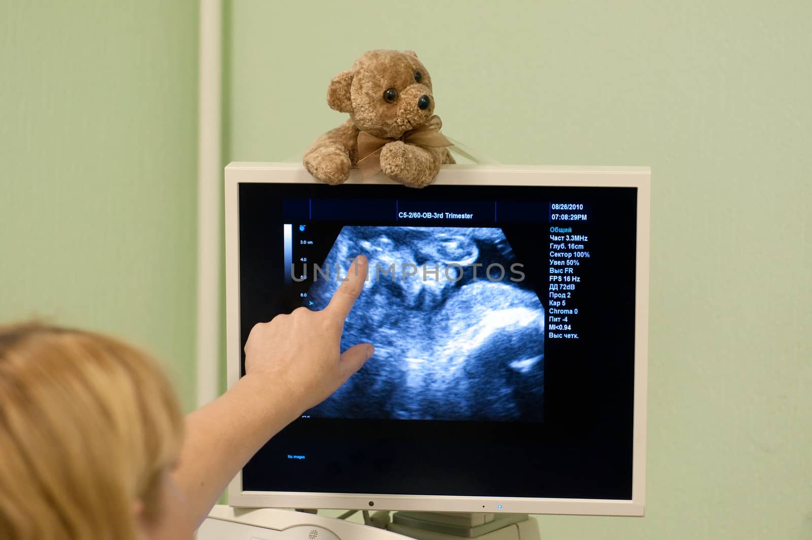 Obstetrician examining pregnant belly by ultrasonic scan.