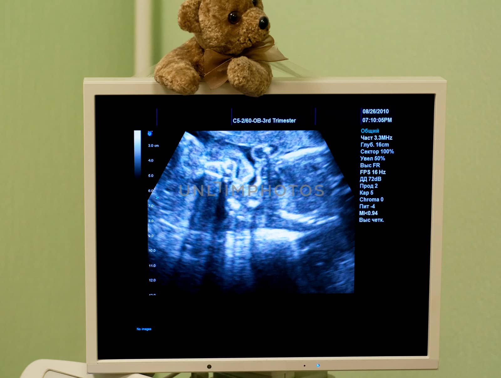 Obstetrician examining pregnant belly by ultrasonic scan.