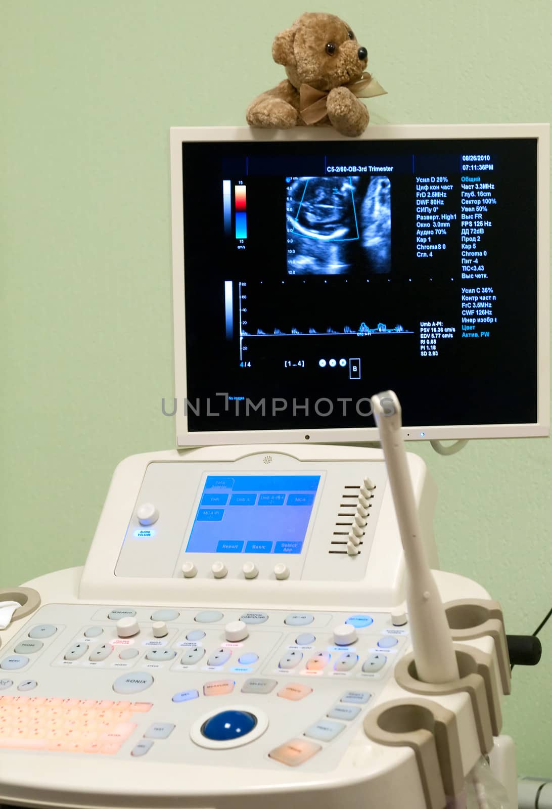 Medical Equipment ultrasound scanning. Diagnosis of pregnancy. by lexan