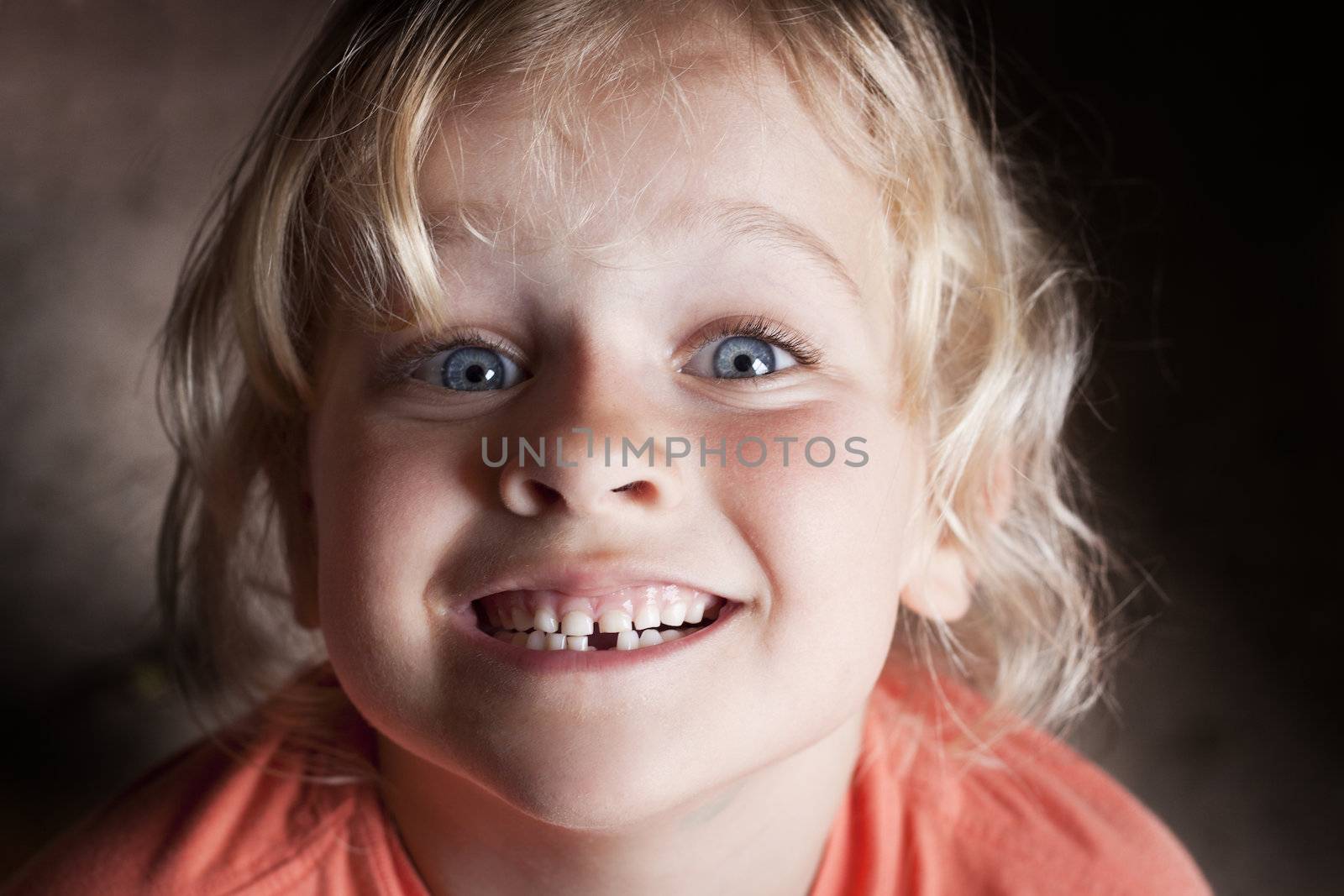 Child with missing tooth by annems