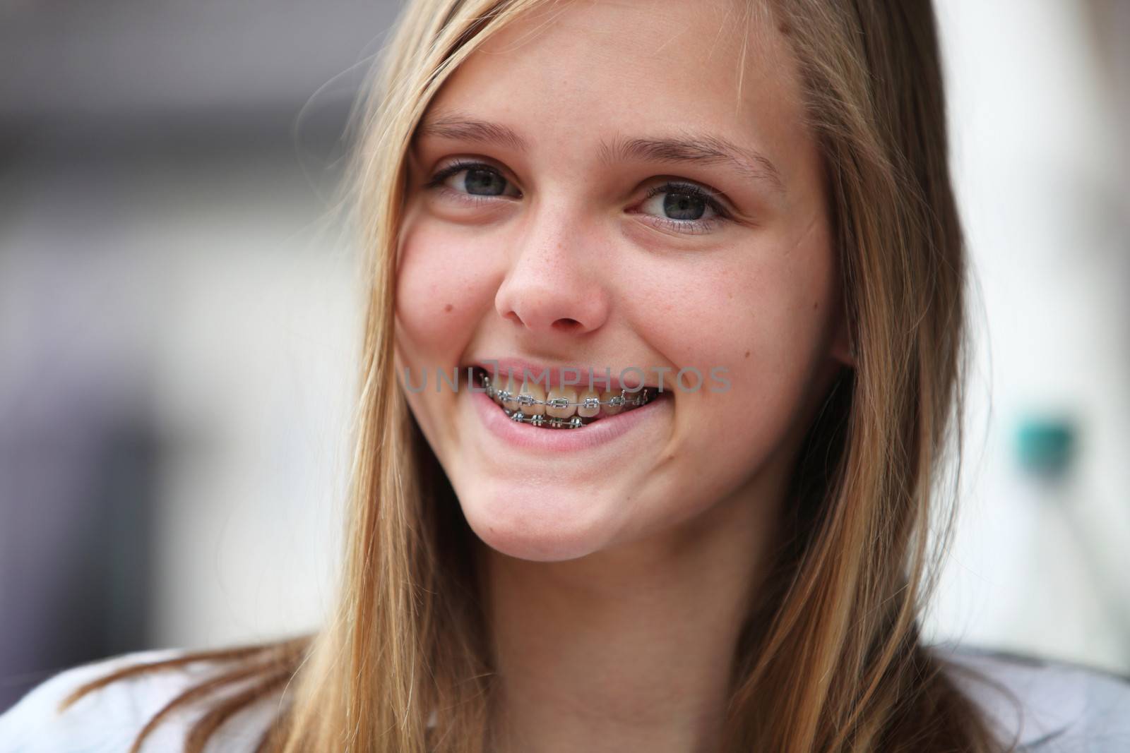 Attractive young teenage girl with orthodontic braces on her upper and lower teeth smiling for the camera